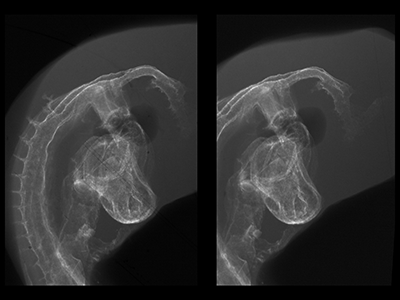 stage 16 chick embryo x-ray