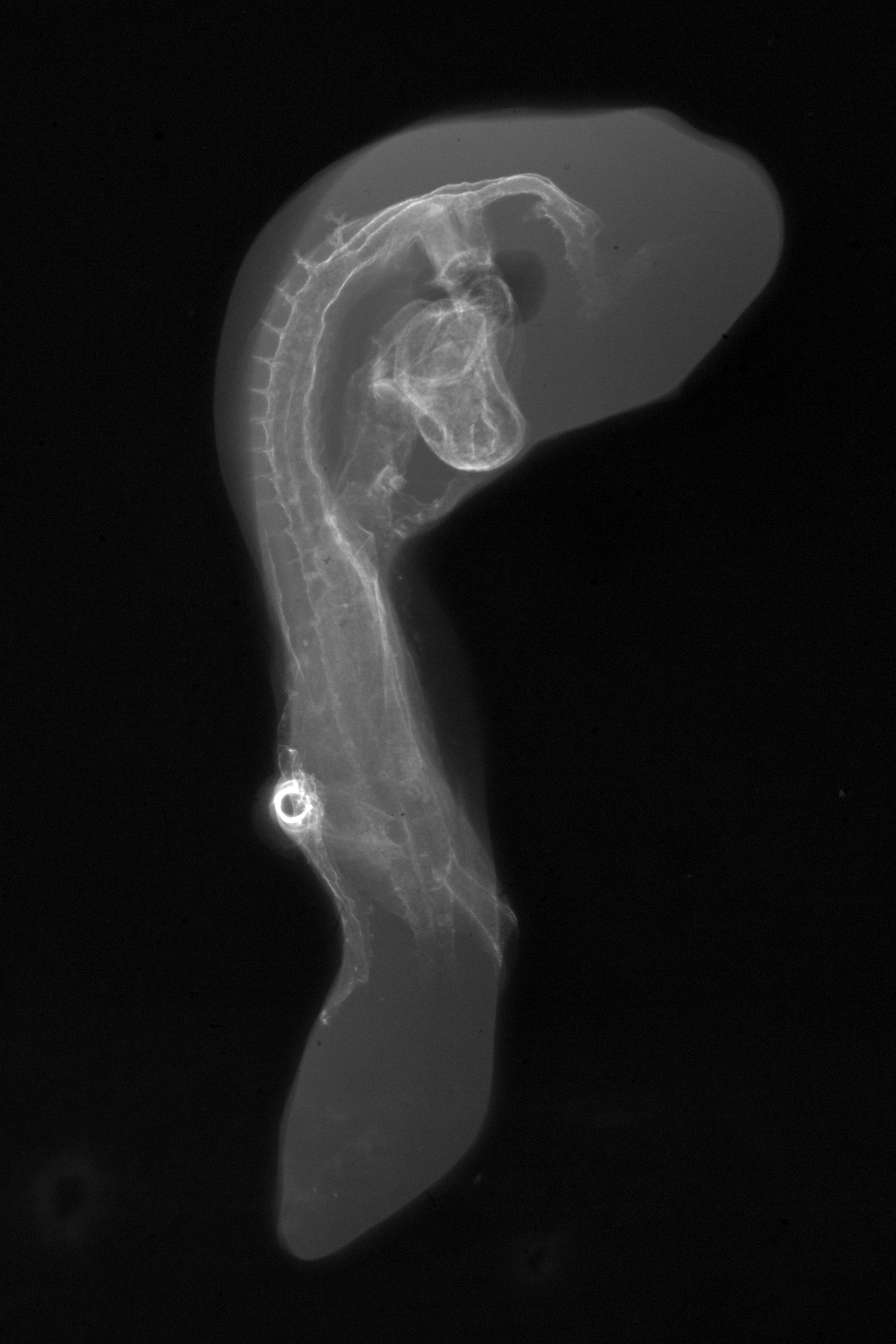 stage 16 chick embryo x-ray