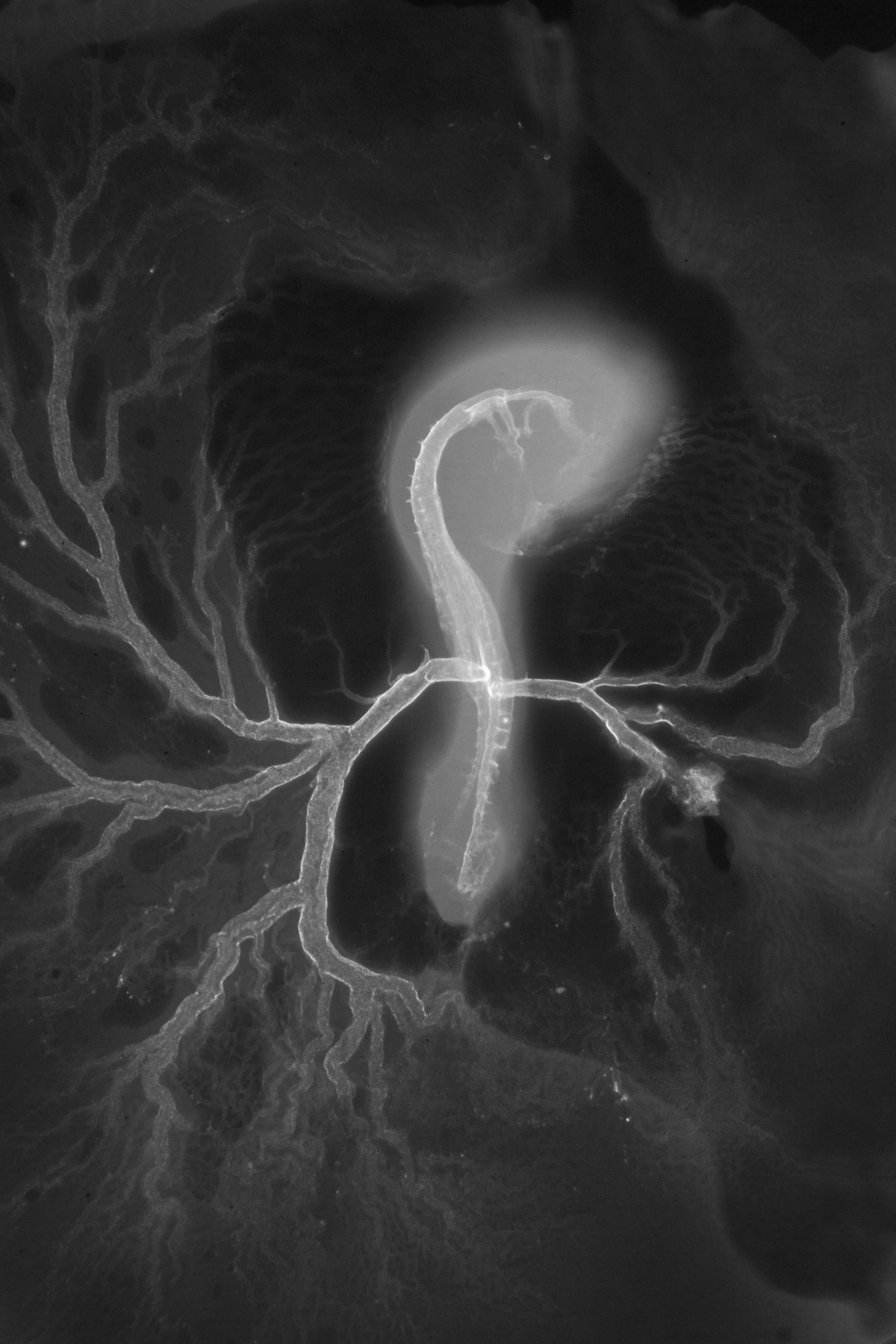 stage 16 chick embryo x-ray