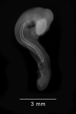 stage 17 chick embryo x-ray