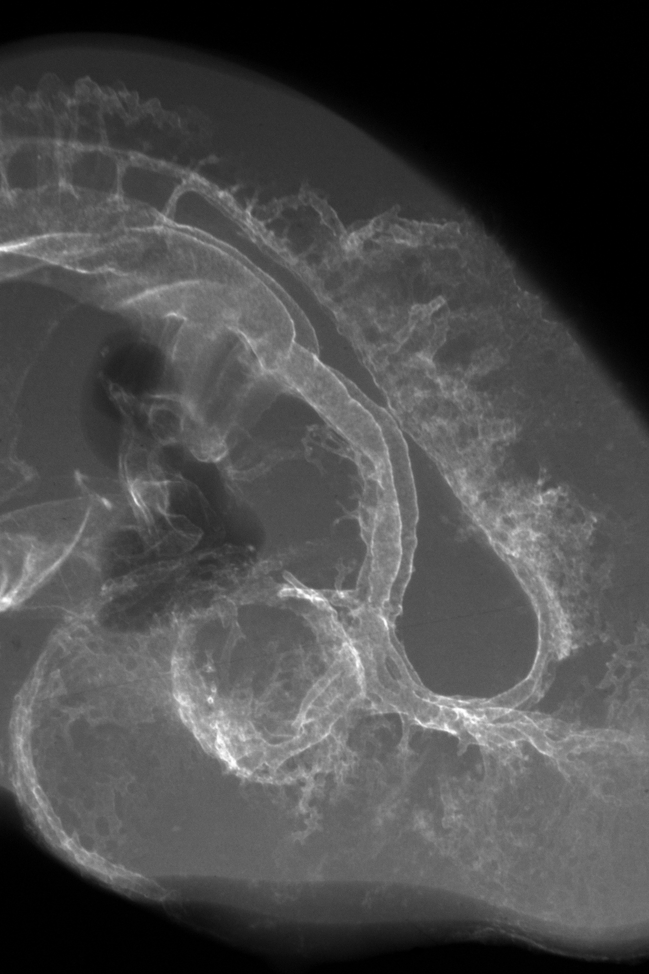 chick embryo x-ray