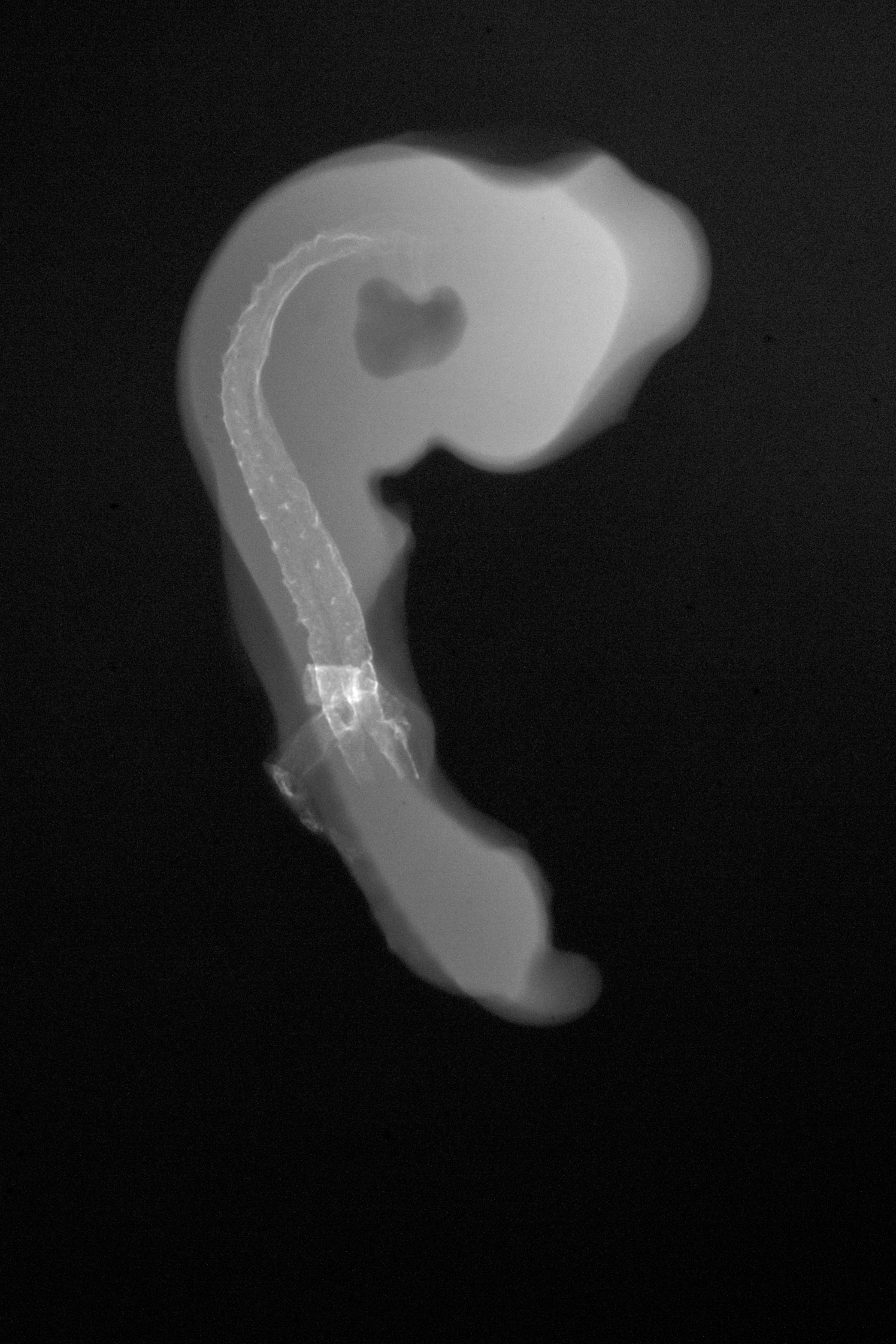stage 18 chick embryo x-ray