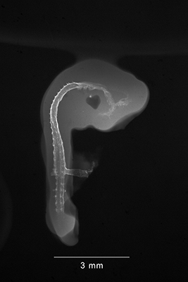 stage 18 chick embryo x-ray