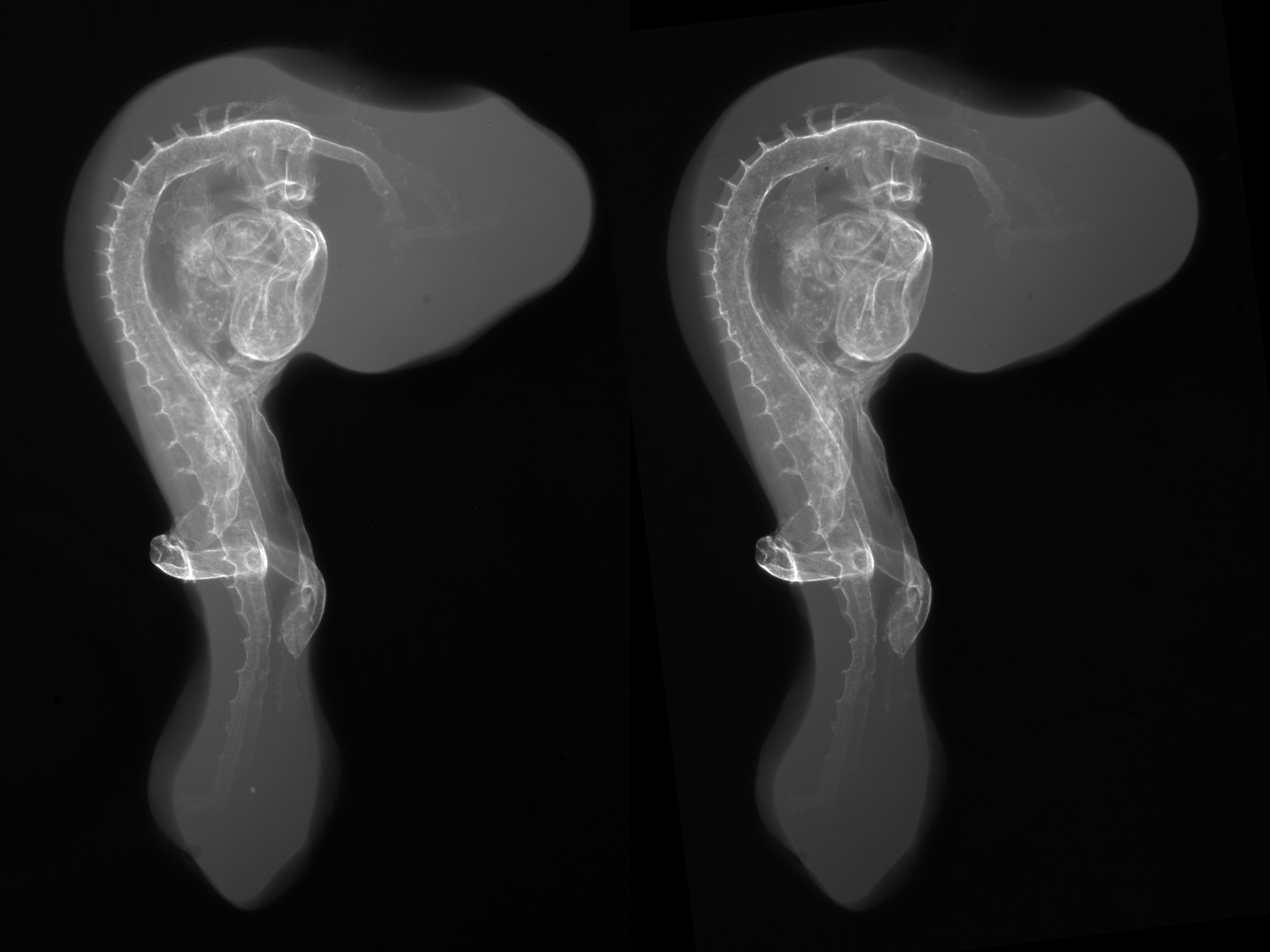 stage 18 chick embryo x-ray