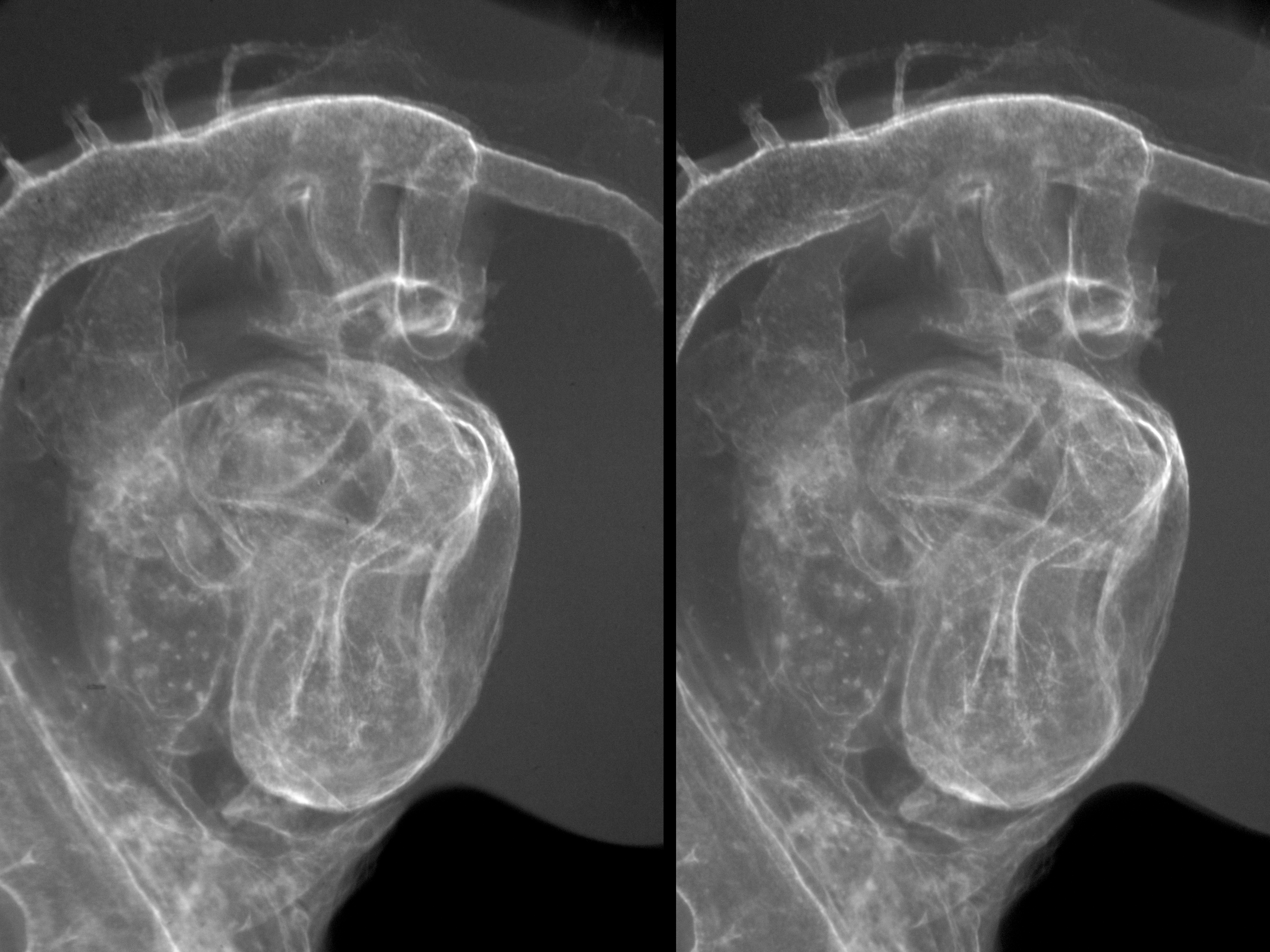 stage 18 chick embryo x-ray