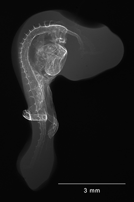 stage 18 chick embryo x-ray