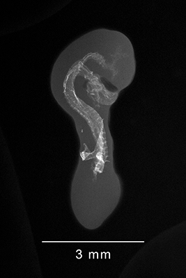 stage 18 chick embryo x-ray