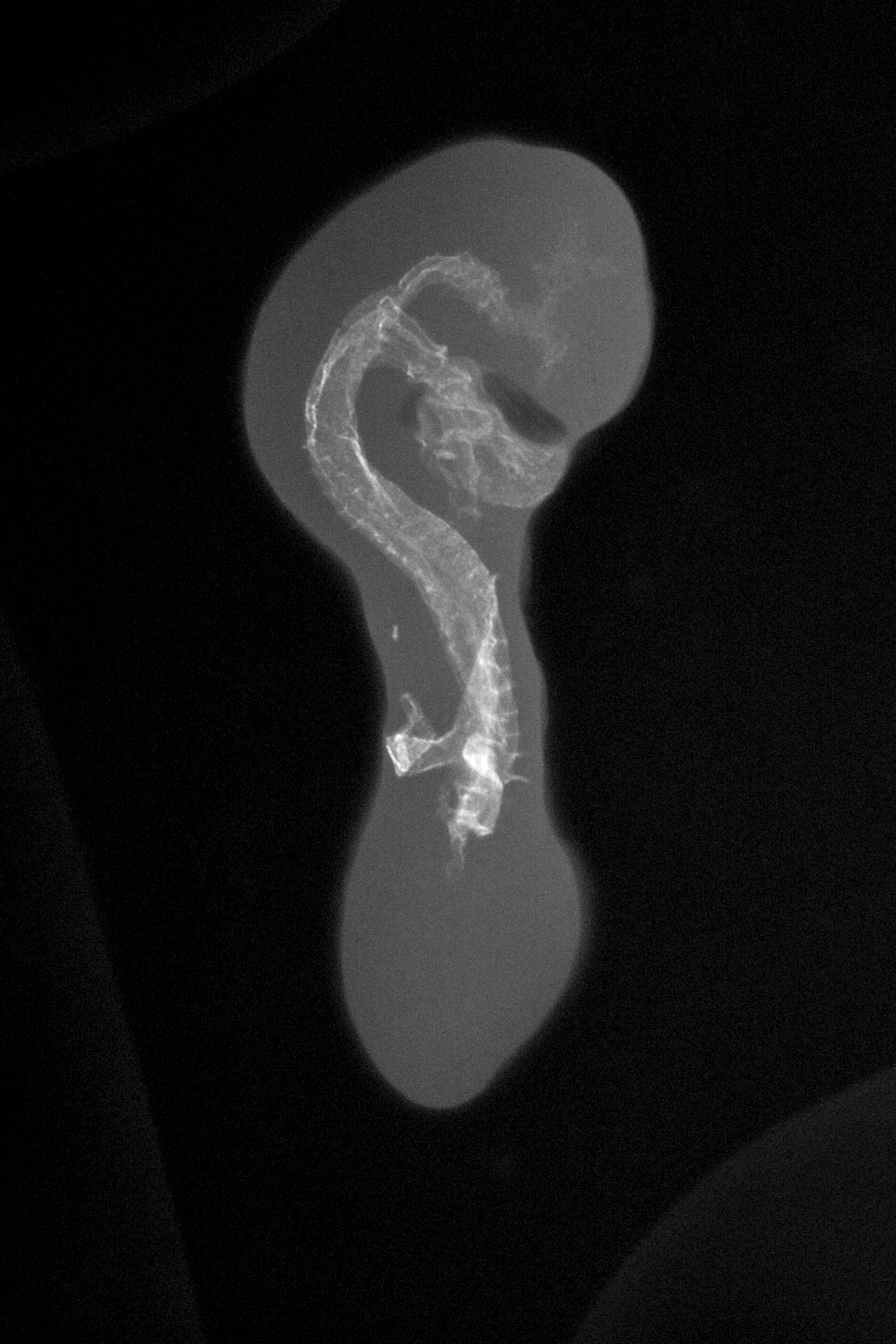 stage 18 chick embryo x-ray