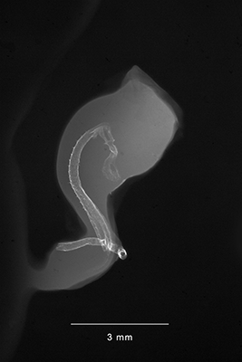 stage 18 chick embryo x-ray