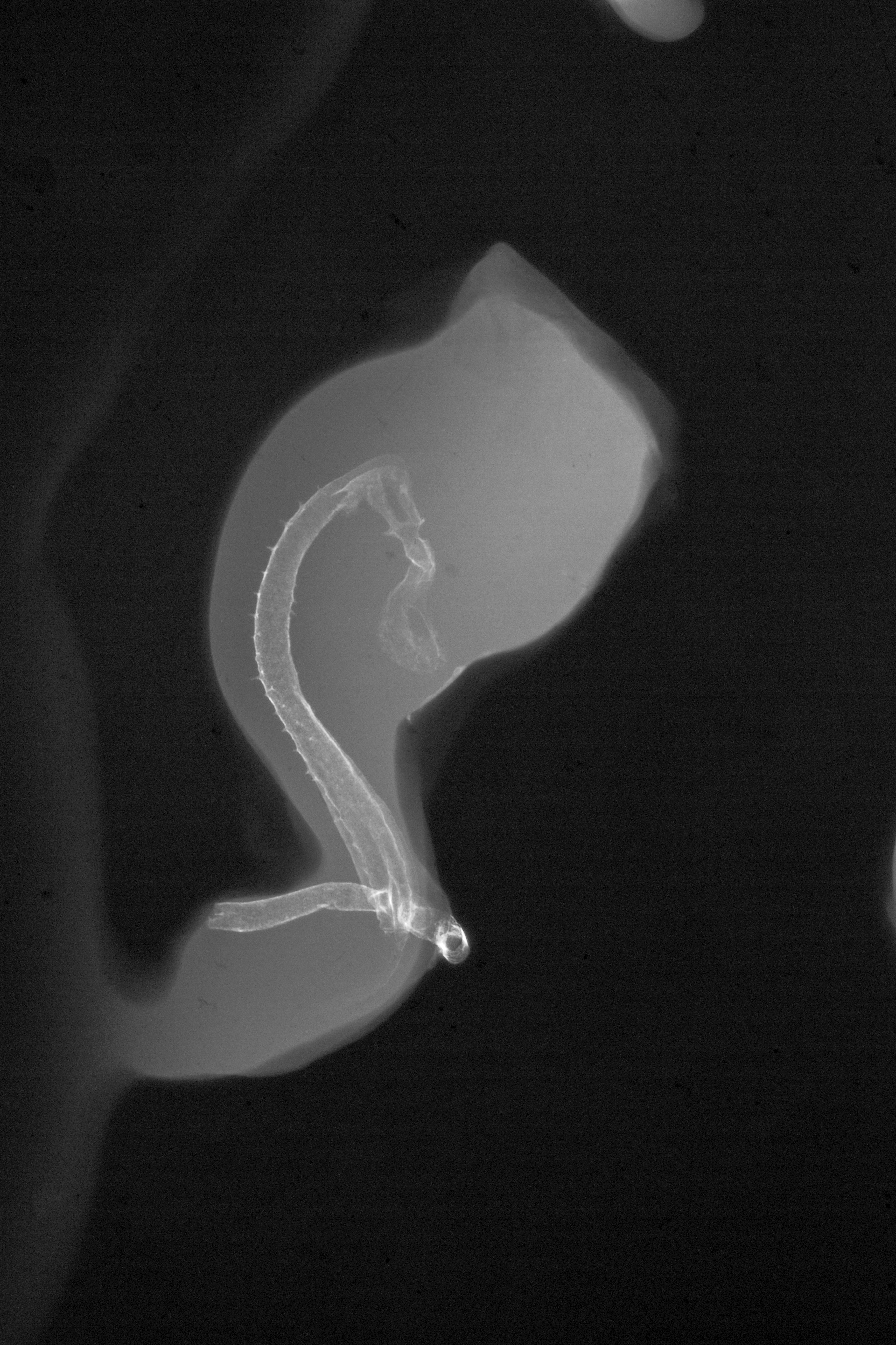 stage 18 chick embryo x-ray