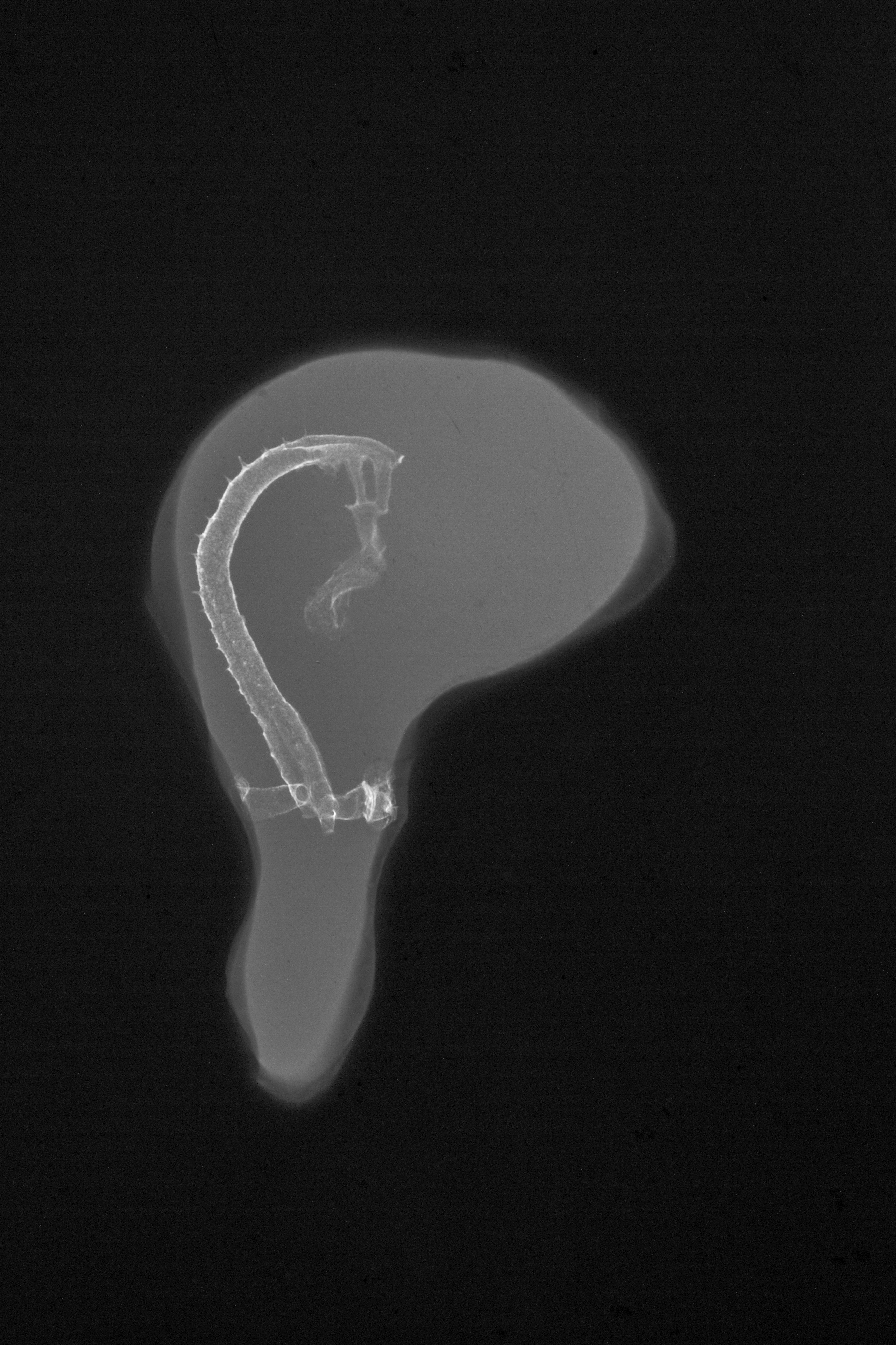 stage 18 chick embryo x-ray