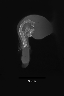 stage 18 chick embryo x-ray