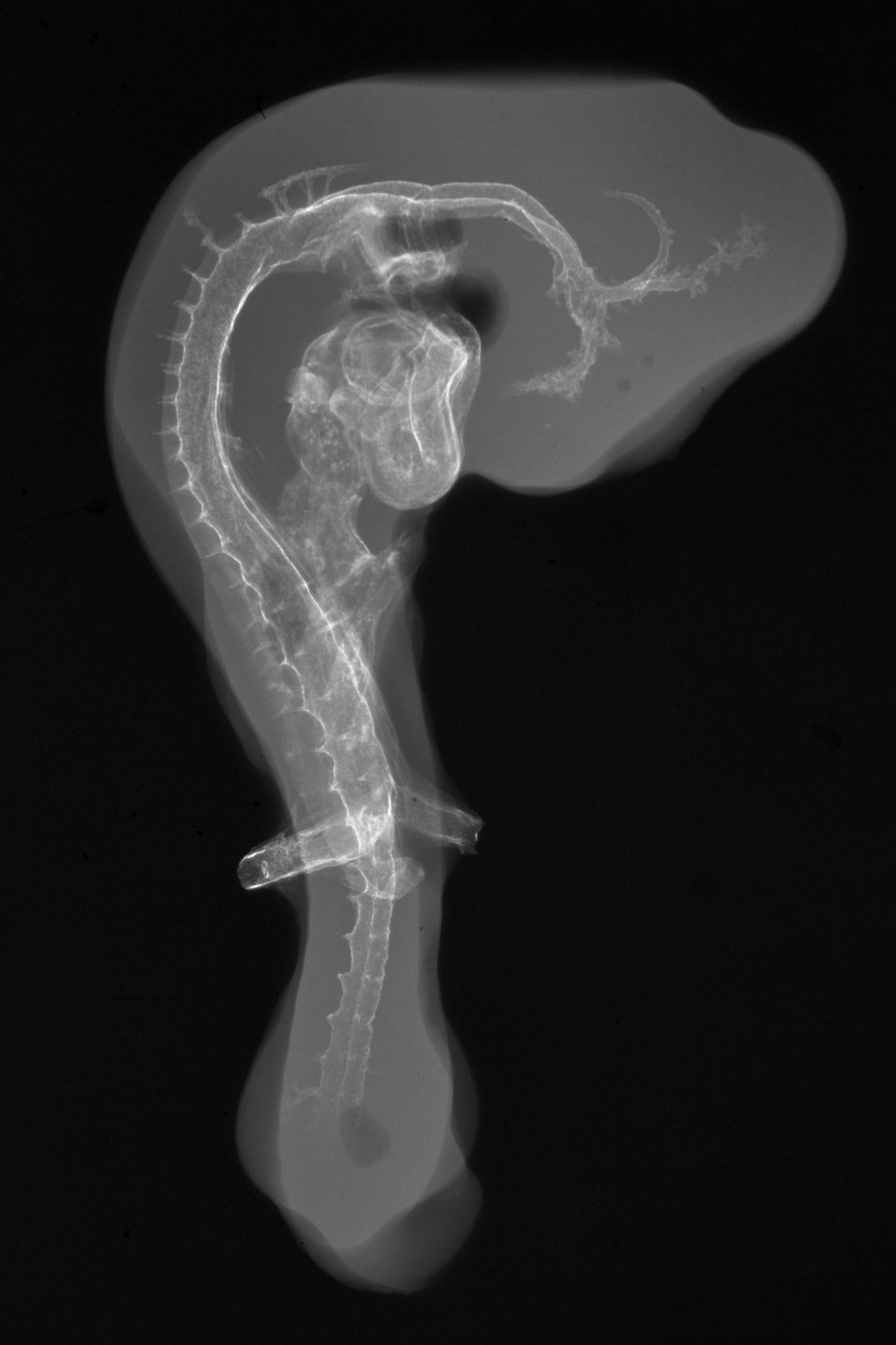 stage 19 chick embryo x-ray