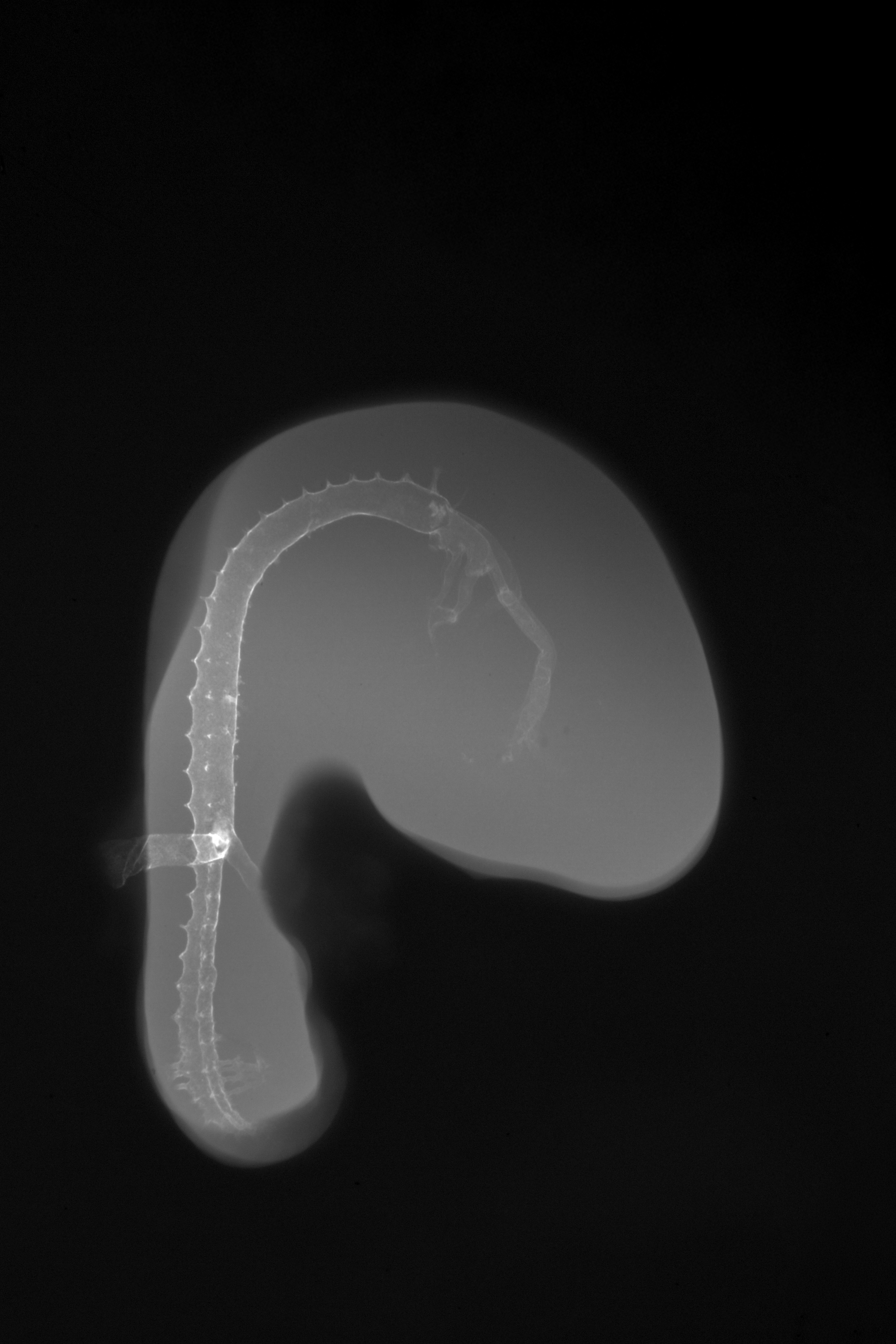 stage 19 chick embryo x-ray
