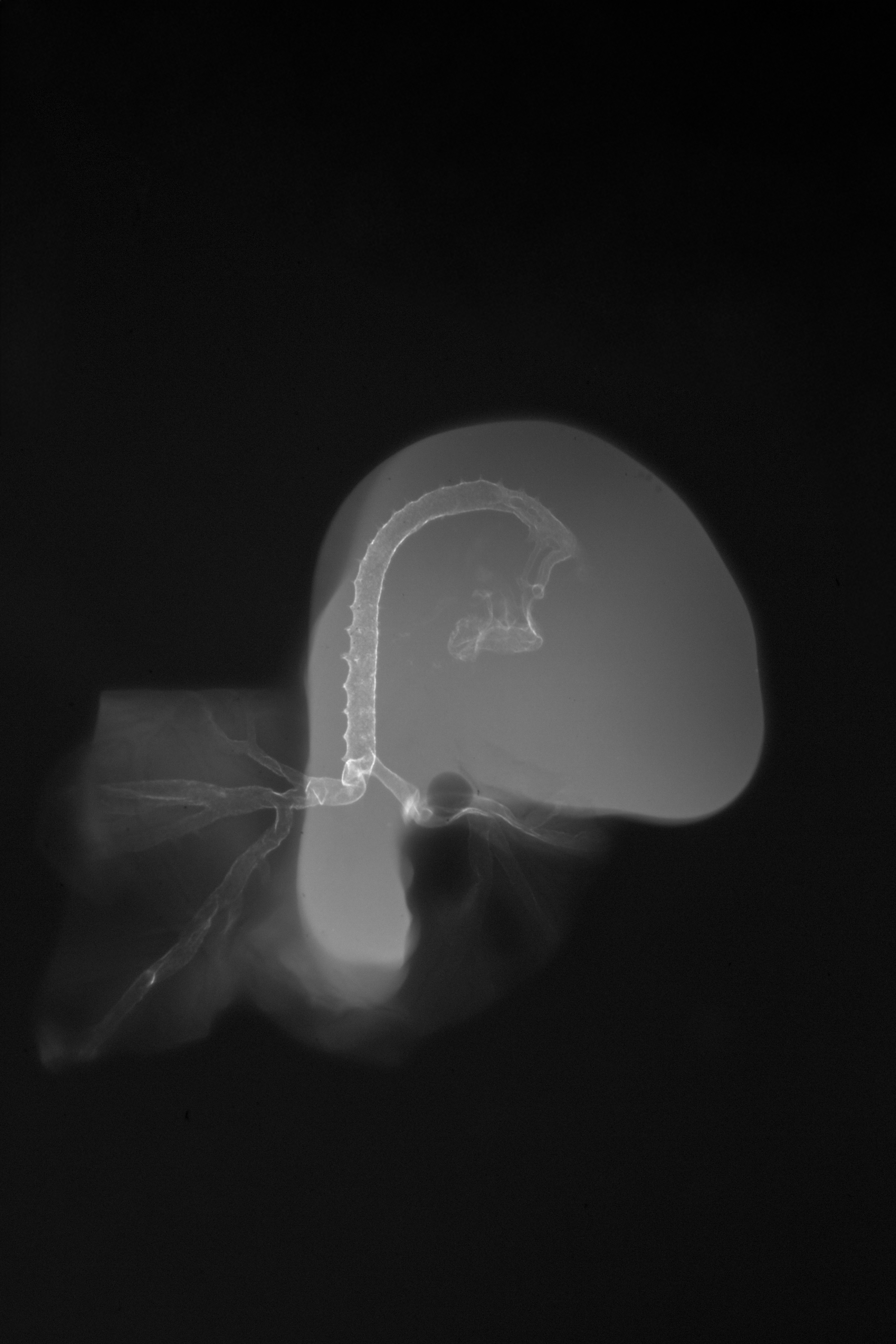 stage 19 chick embryo x-ray
