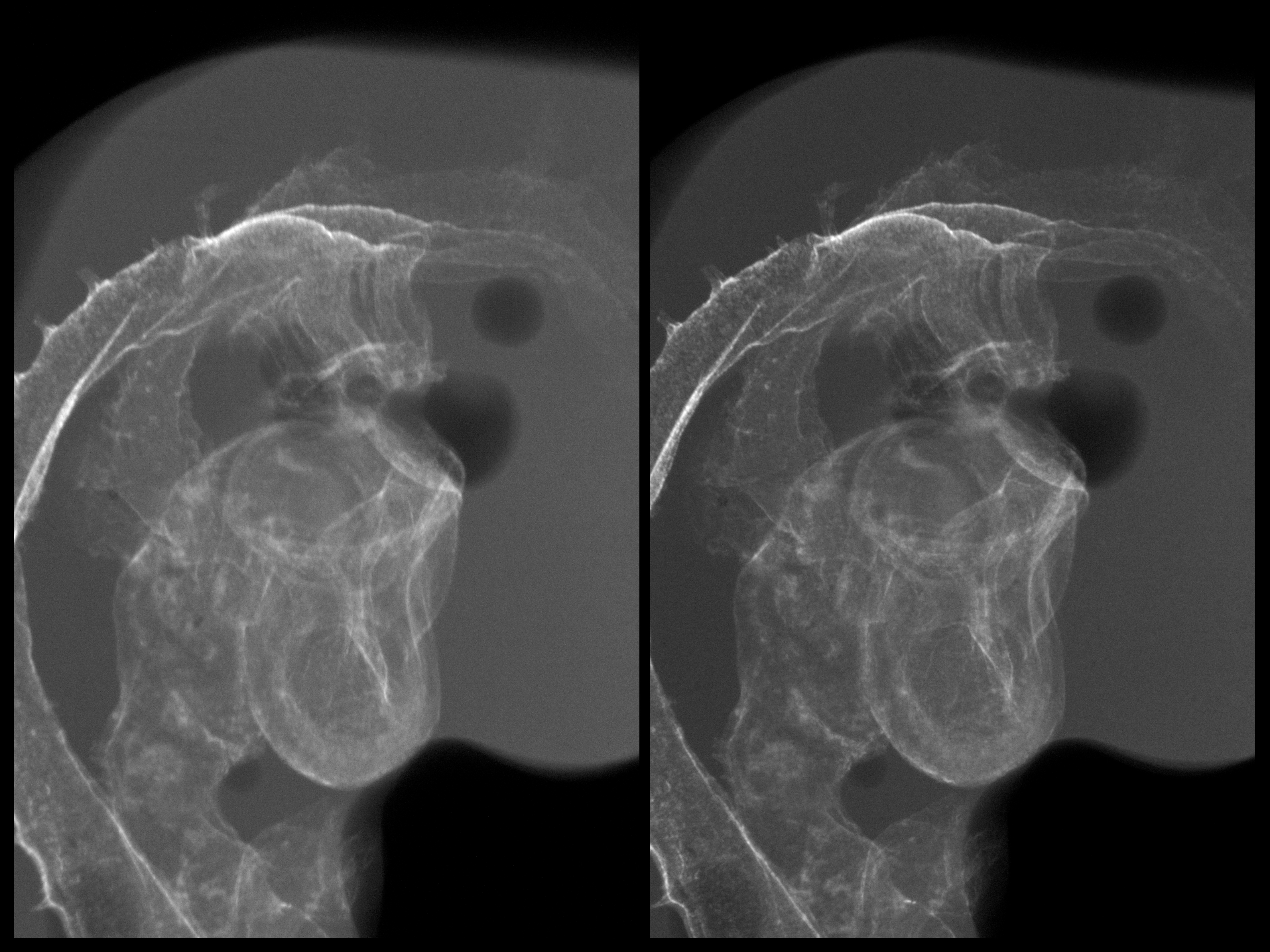 stage 20 chick embryo x-ray