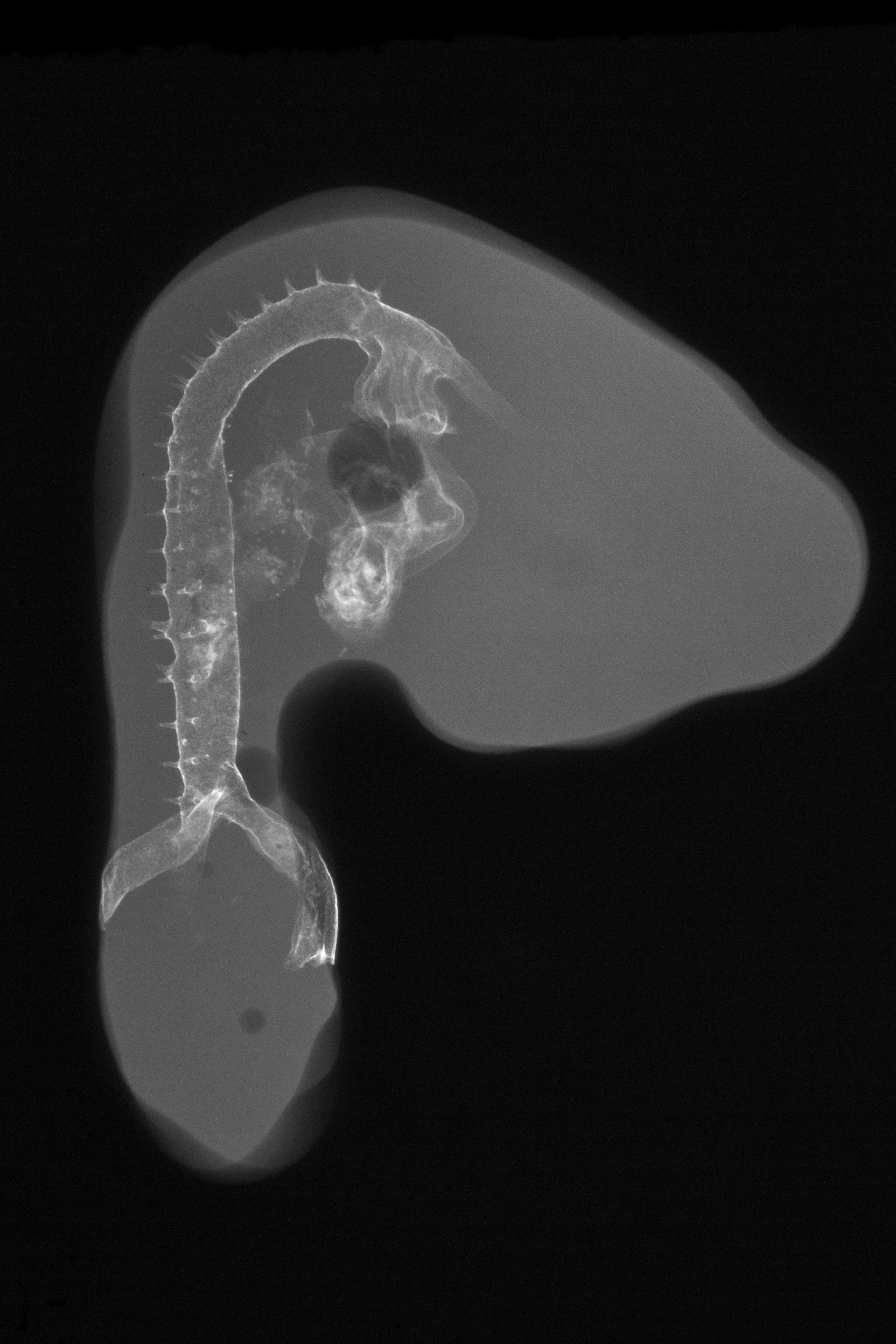 stage 21 chick embryo x-ray
