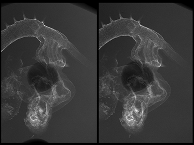 stage 21 chick embryo x-ray