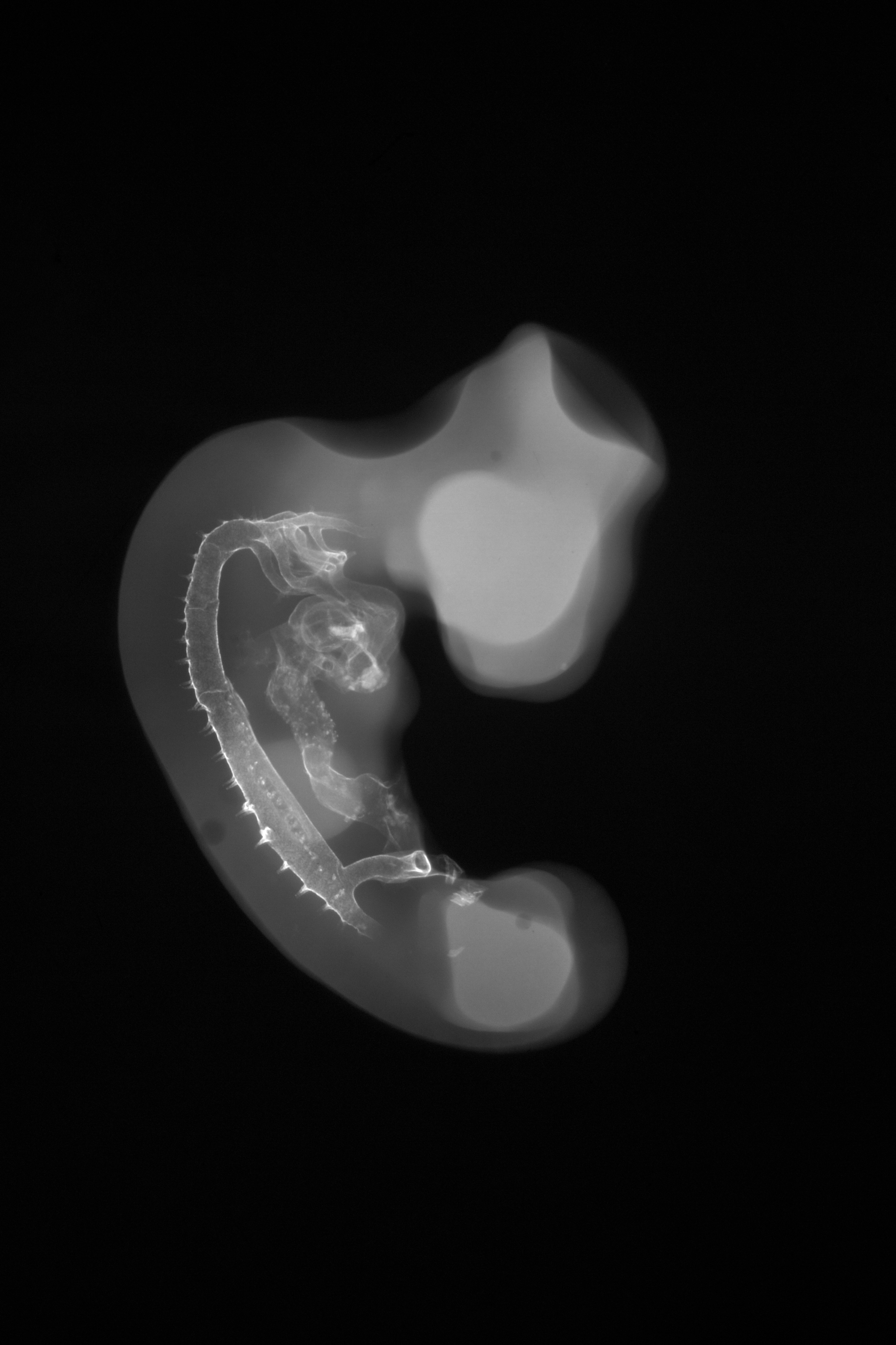 stage 21 chick embryo x-ray