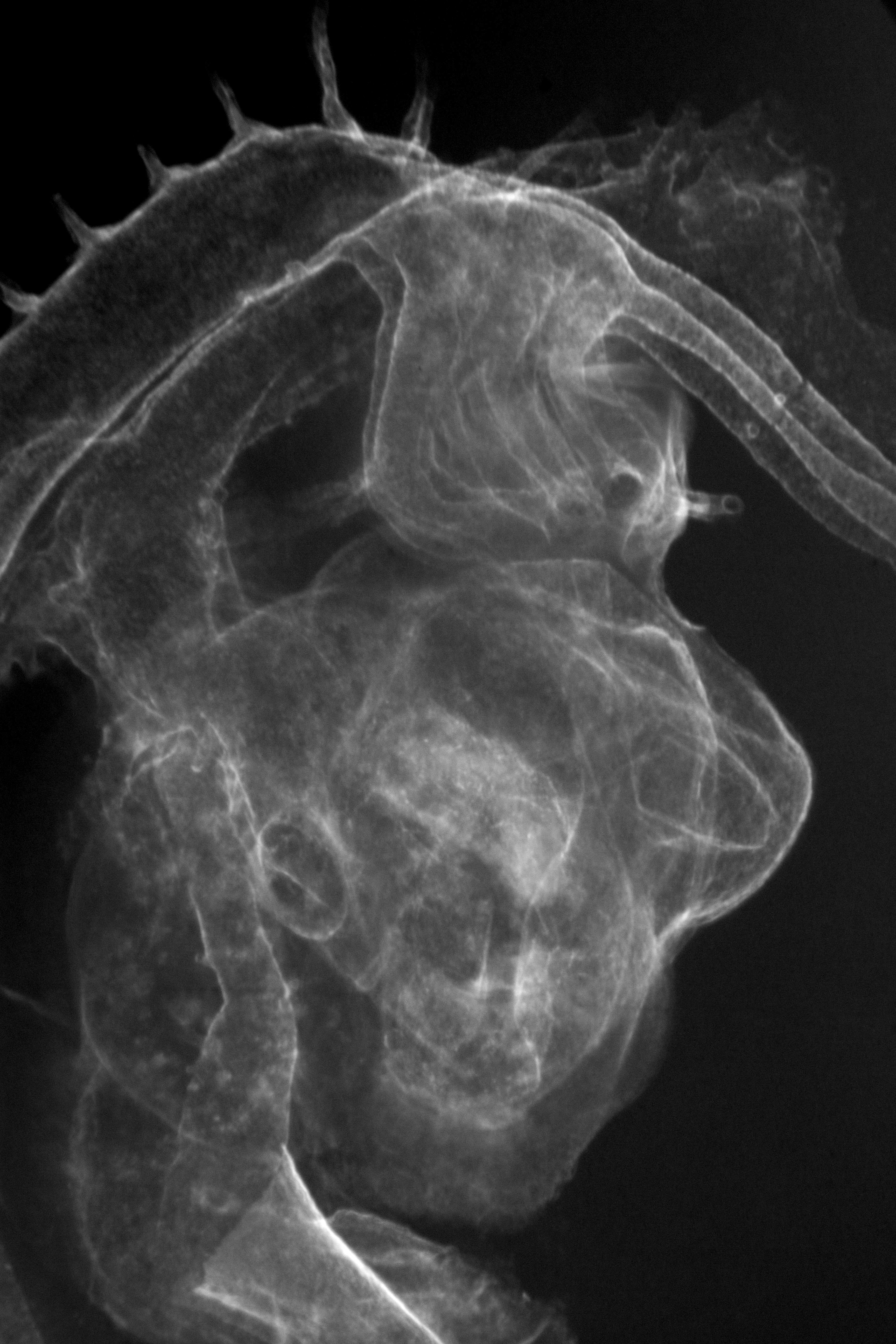 stage 22 chick embryo x-ray