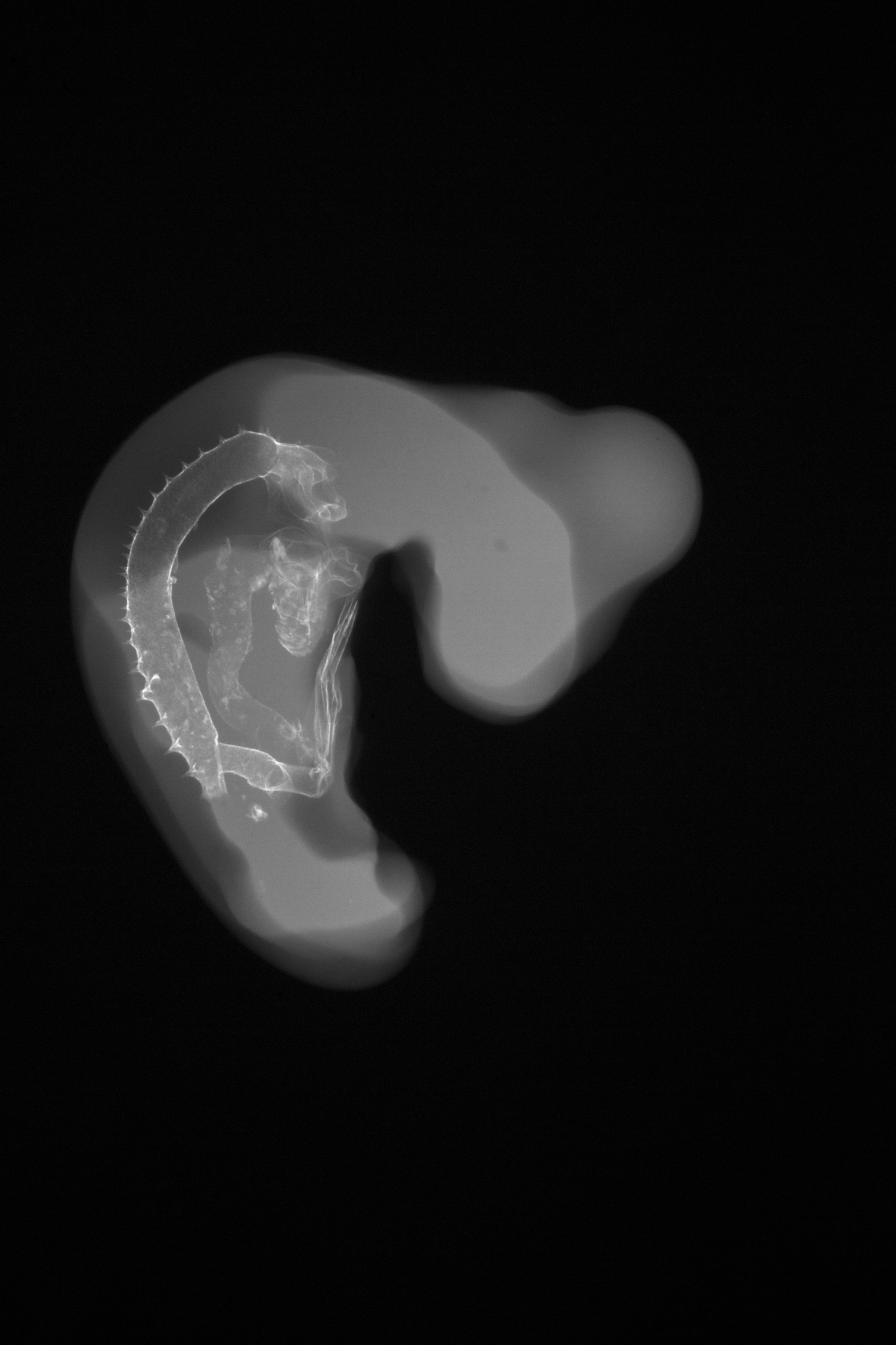 stage 22 chick embryo x-ray