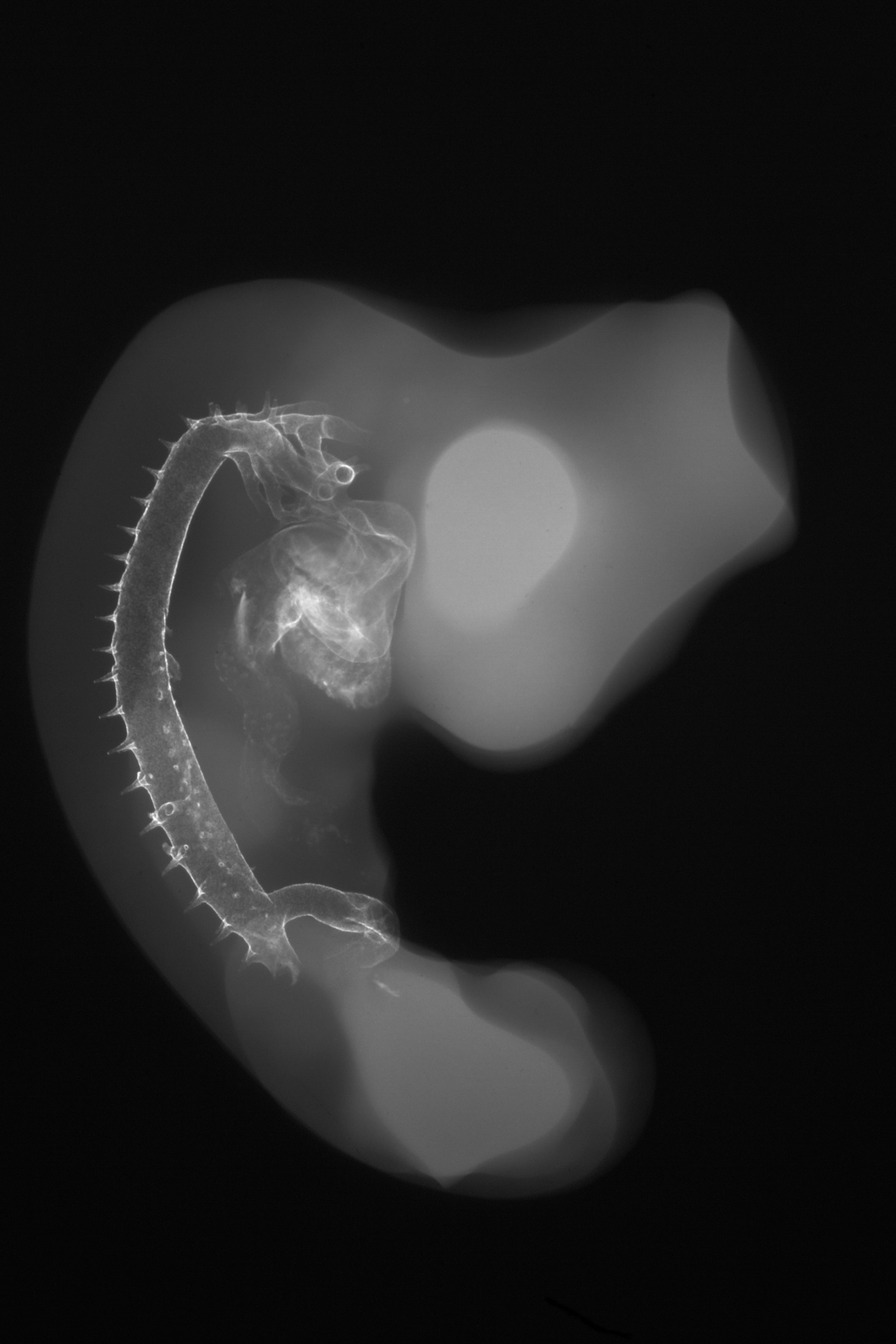stage 22 chick embryo x-ray