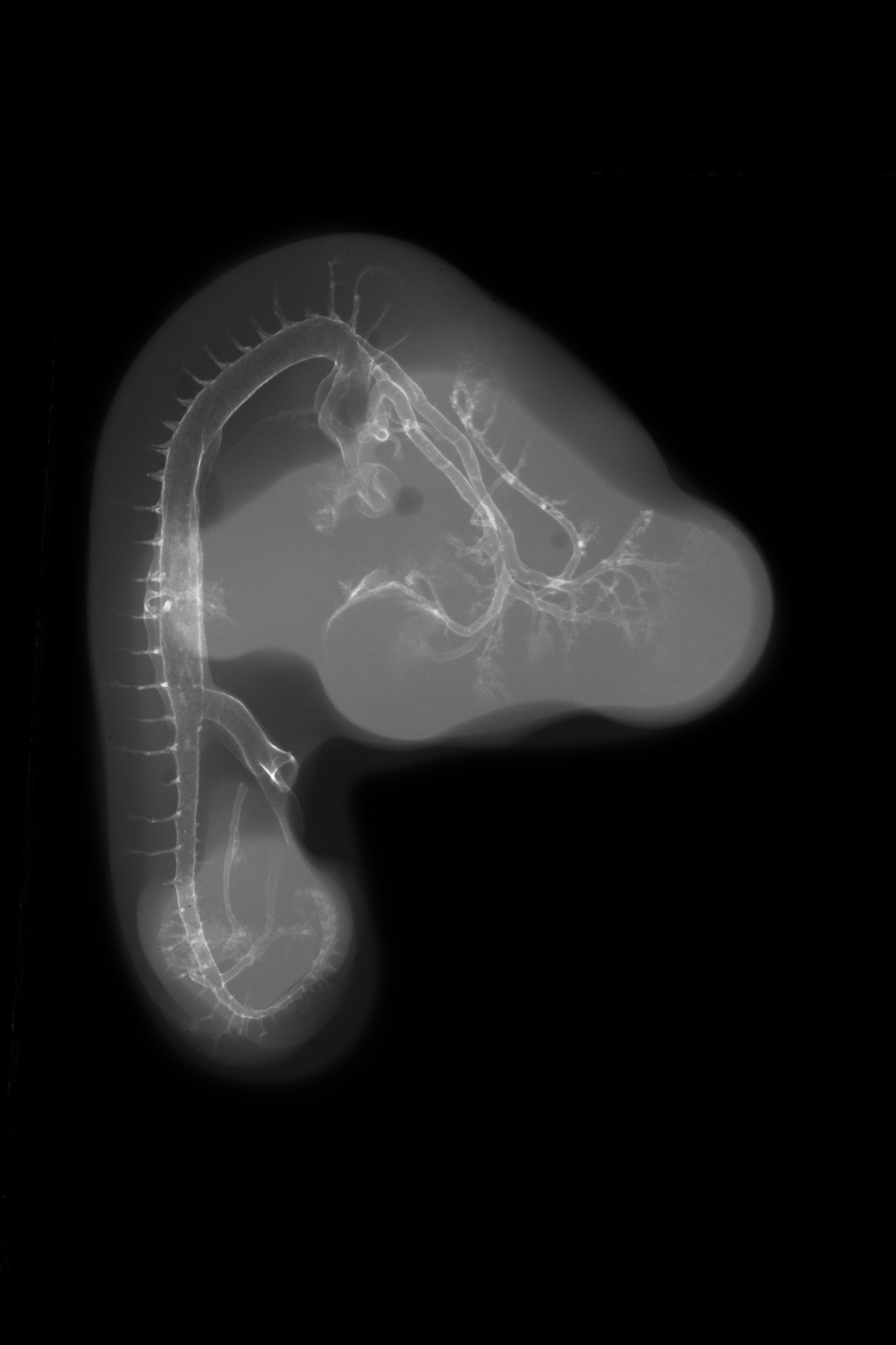 stage 24 chick embryo x-ray