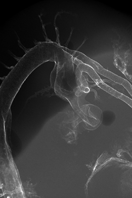 stage 24 chick embryo x-ray