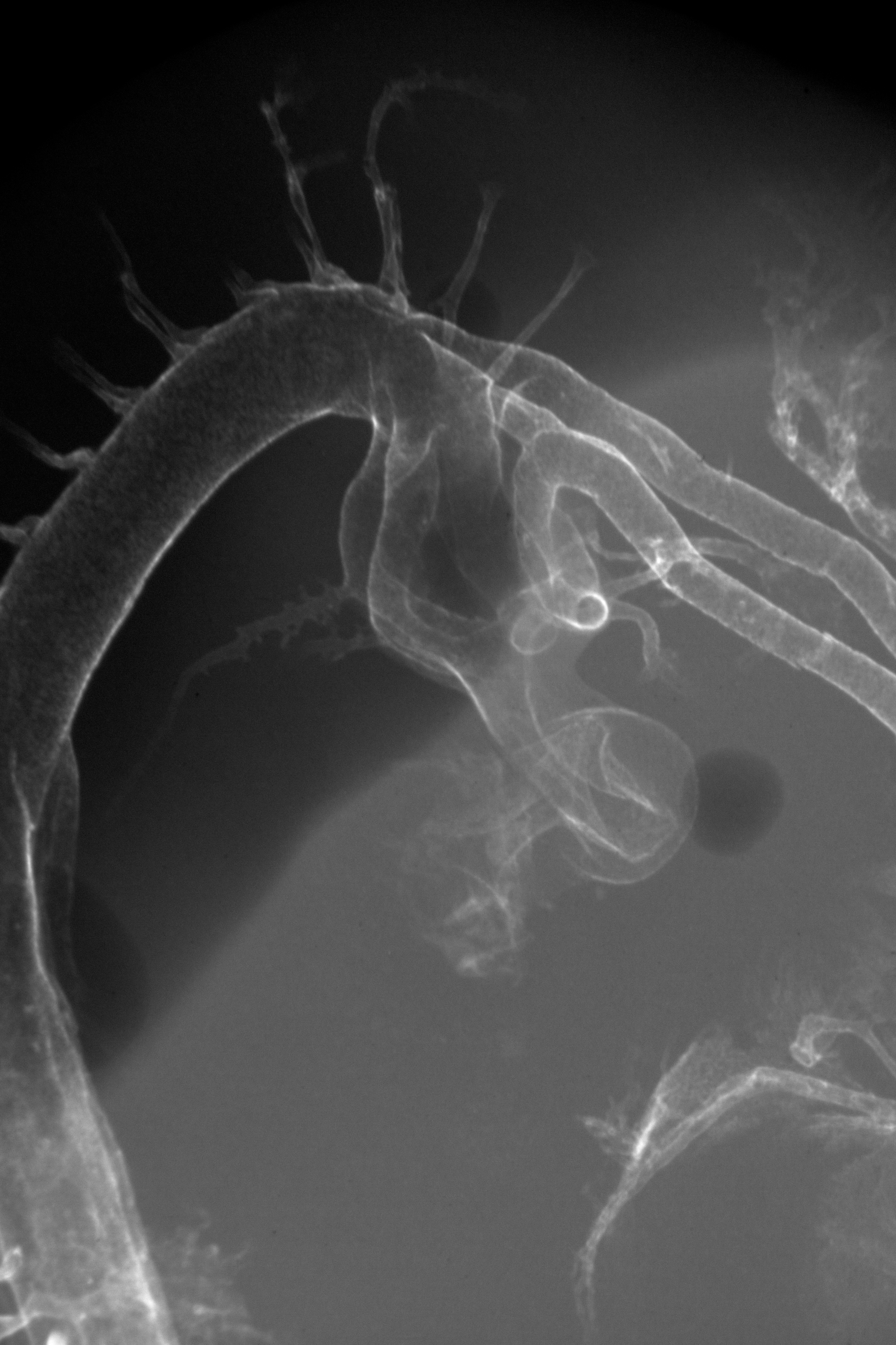 stage 24 chick embryo x-ray