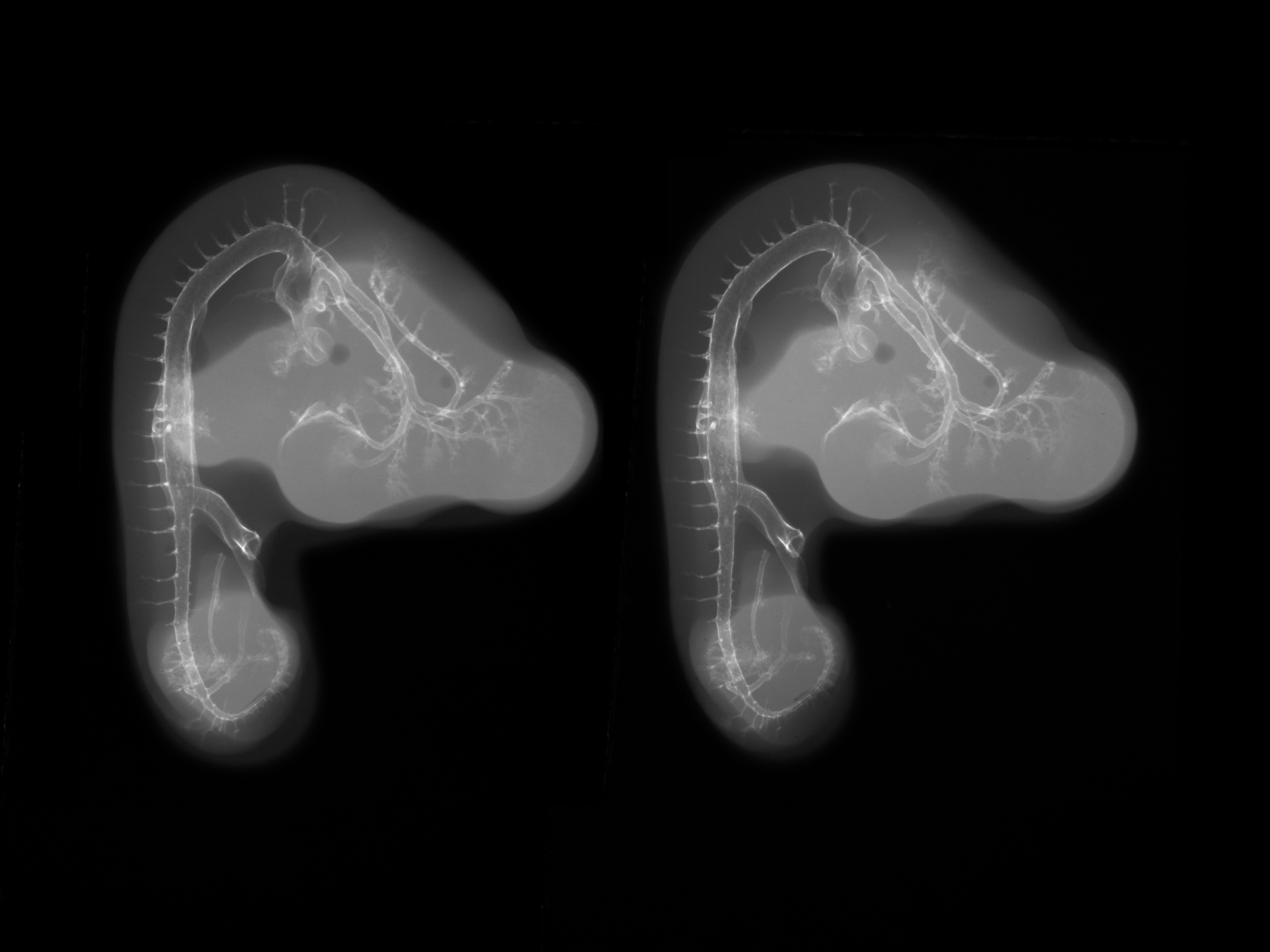 stage 24 chick embryo x-ray