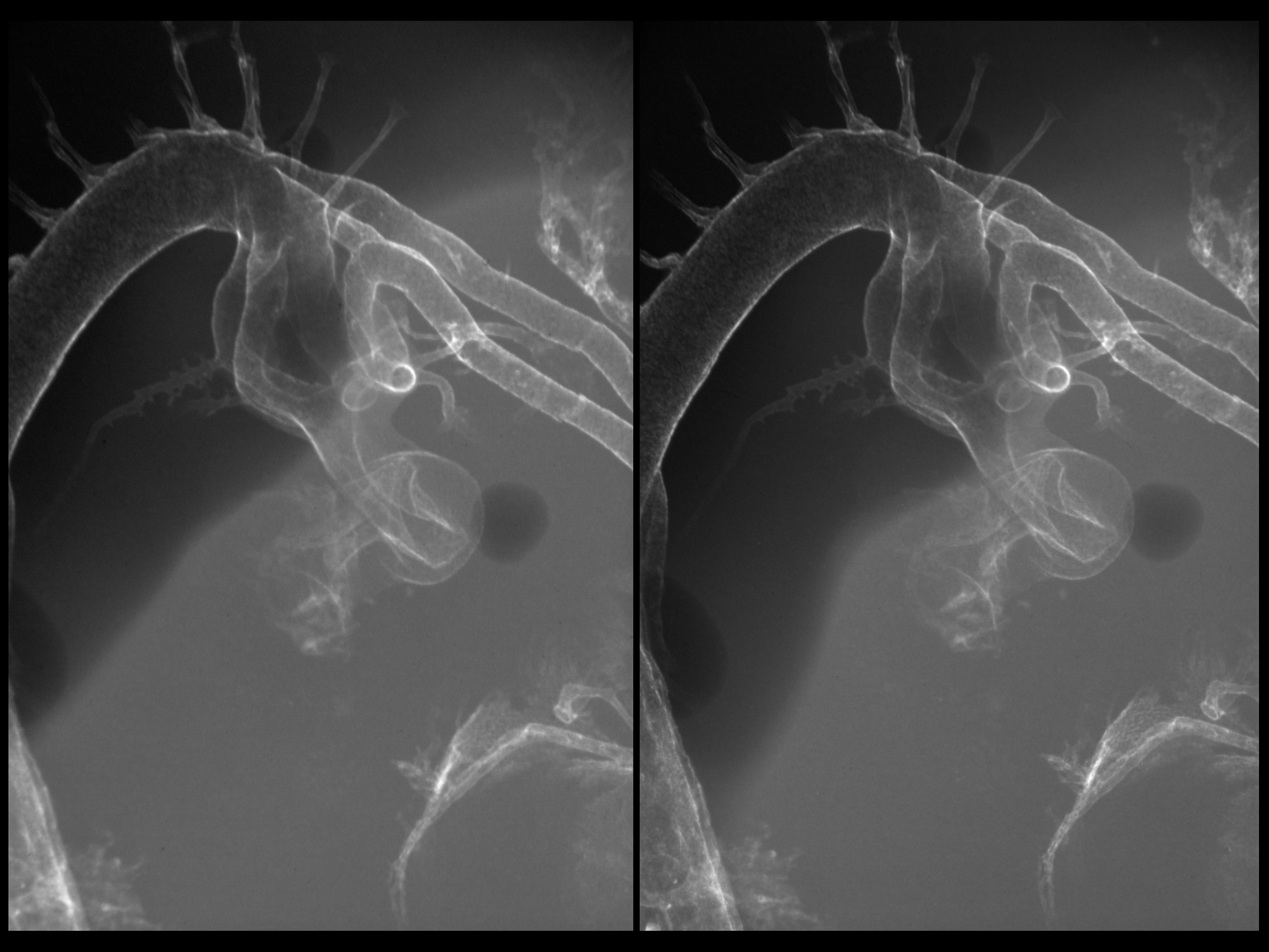 stage 24 chick embryo x-ray
