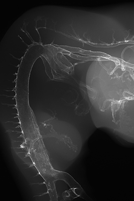 stage 25 chick embryo x-ray