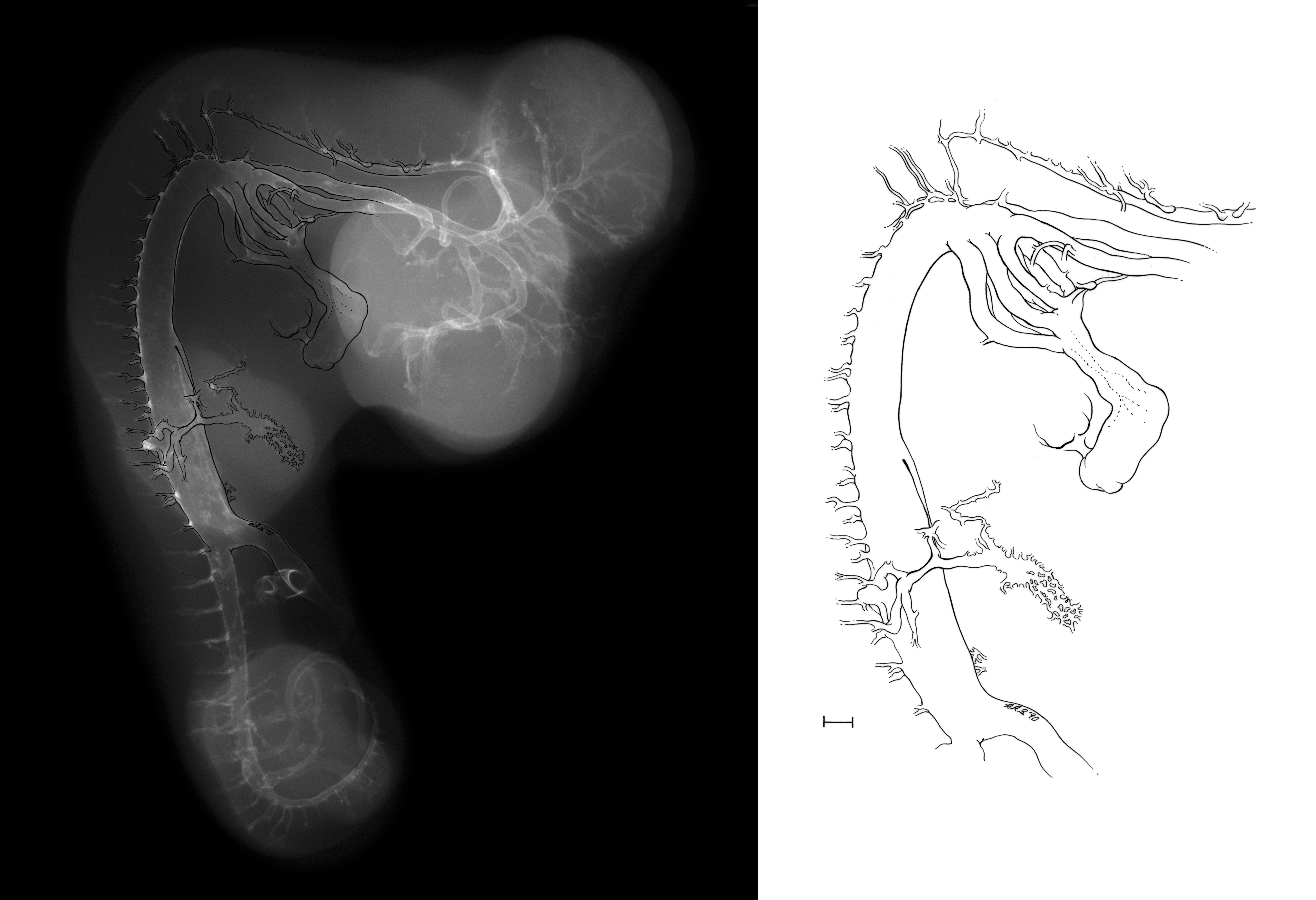 stage 35 chick embryo x-ray