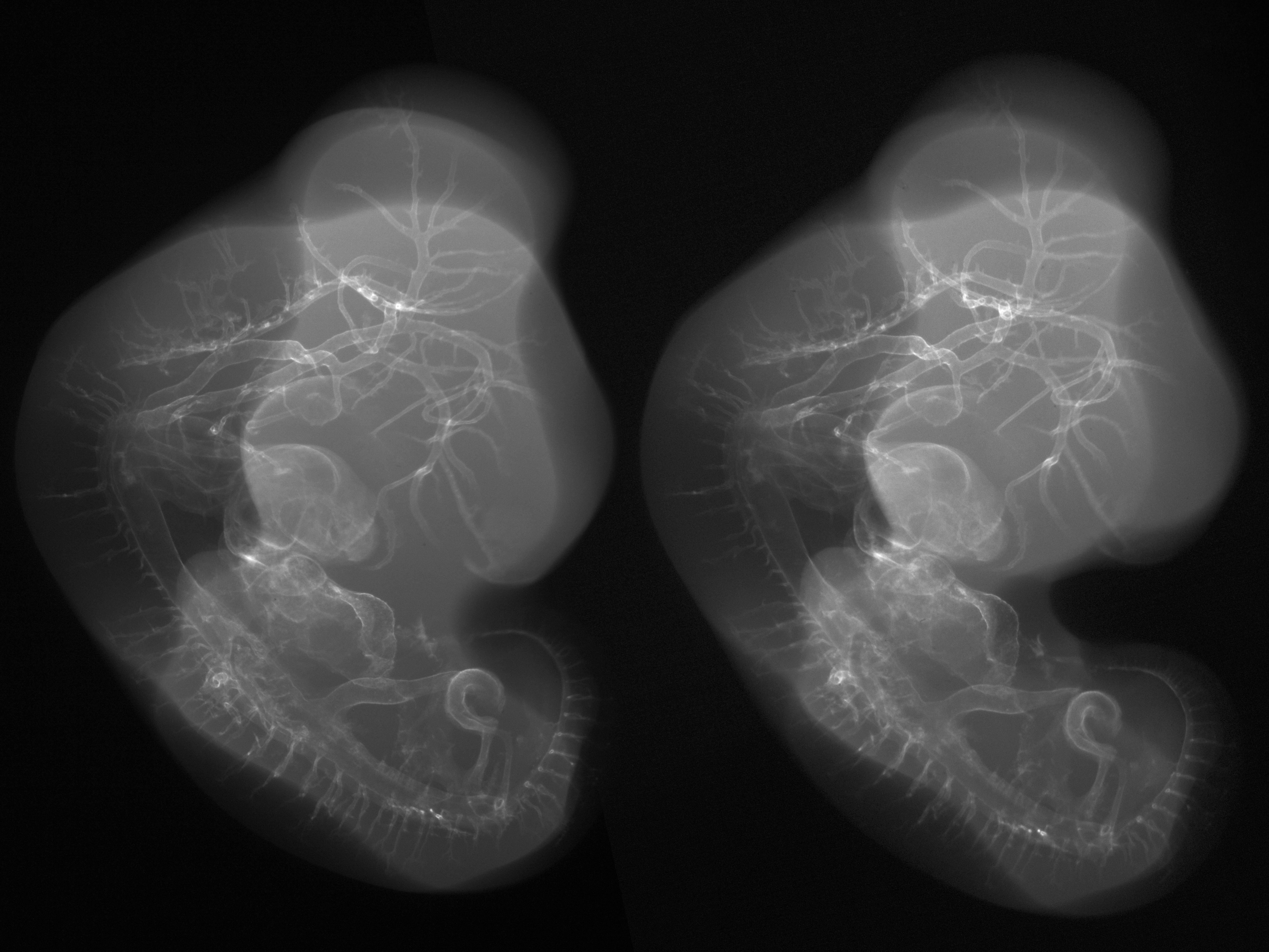 stage 26 chick embryo x-ray