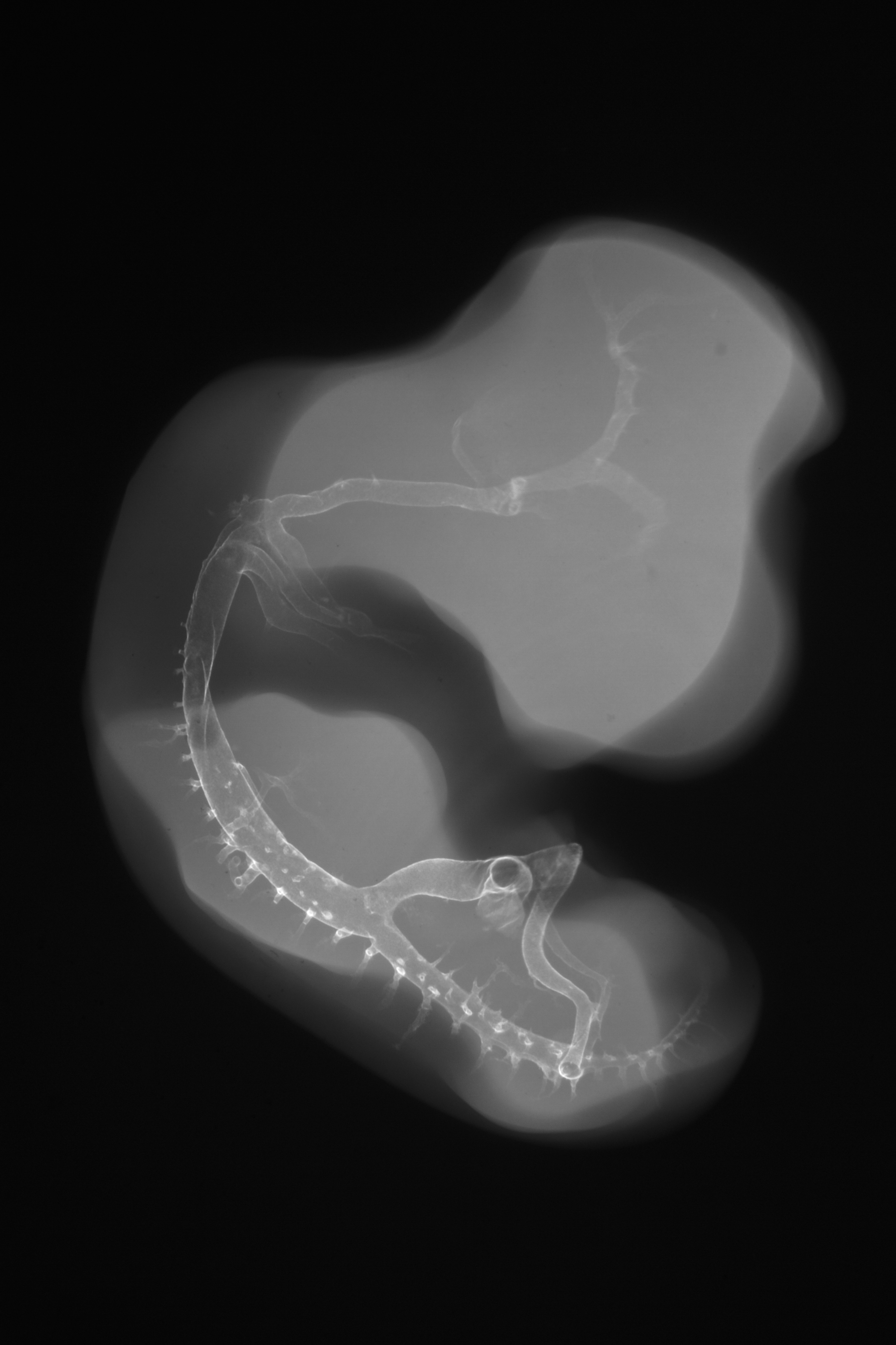 stage 26 chick embryo x-ray