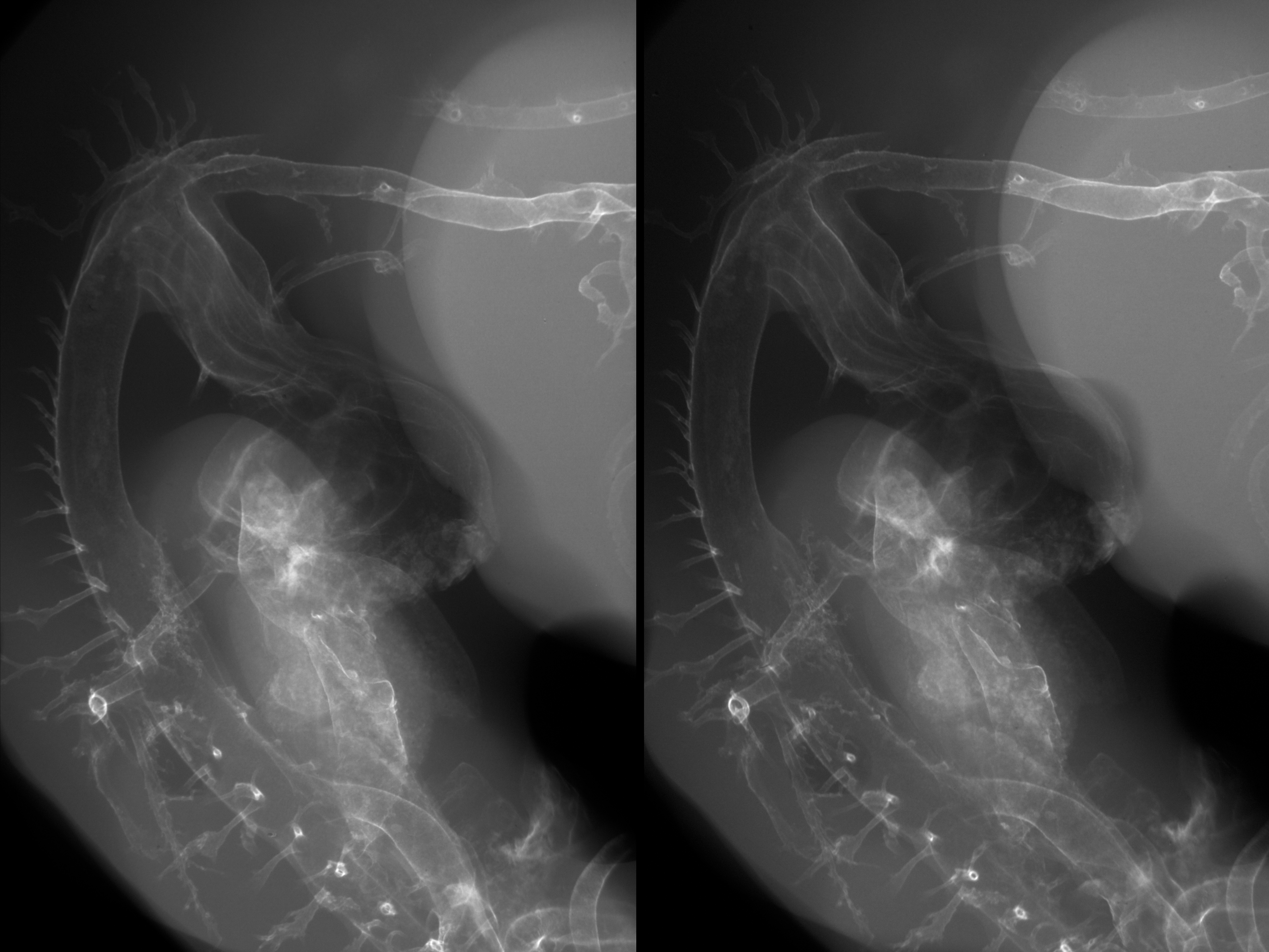 stage 27 chick embryo x-ray