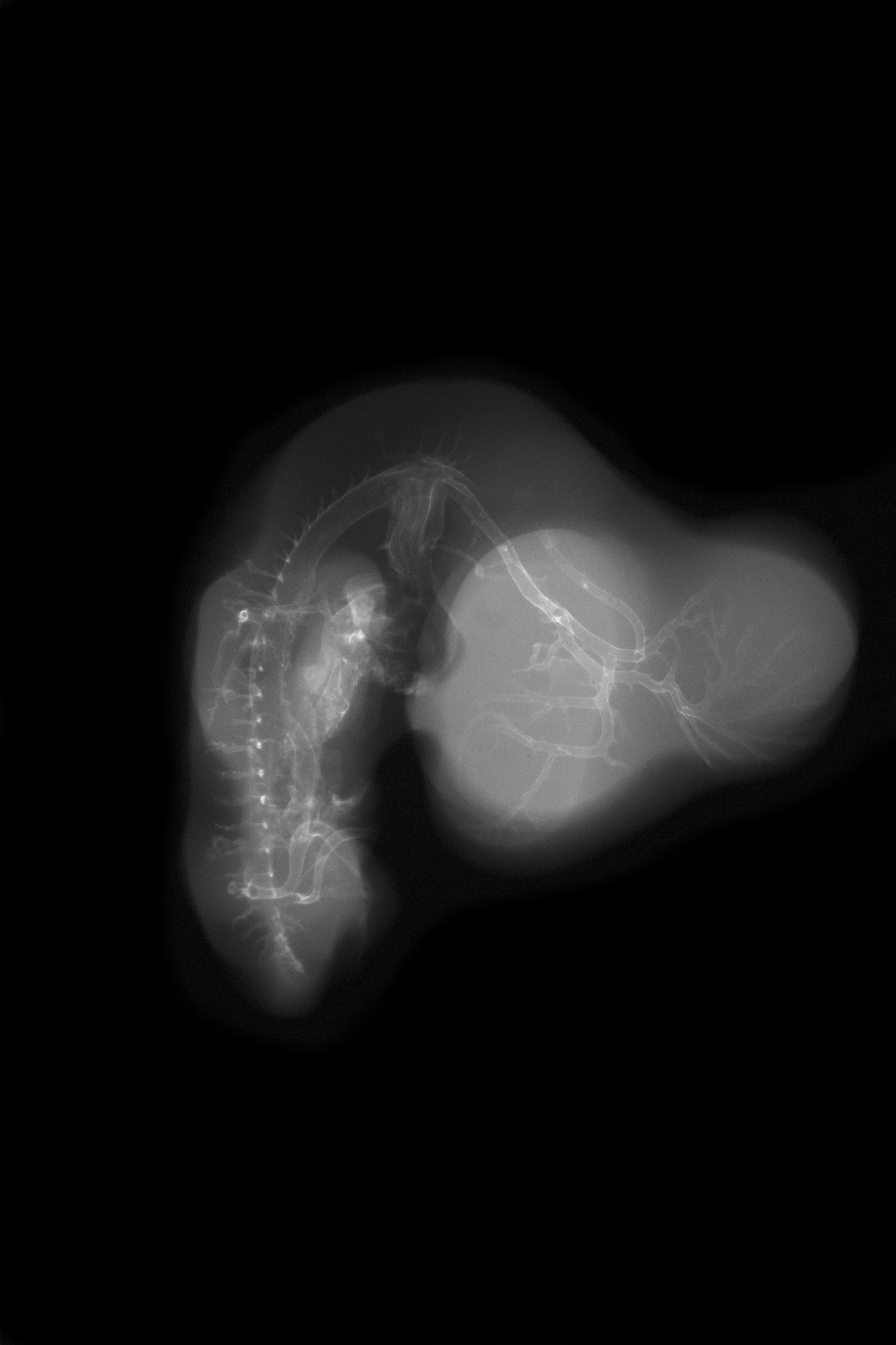 stage 27 chick embryo x-ray