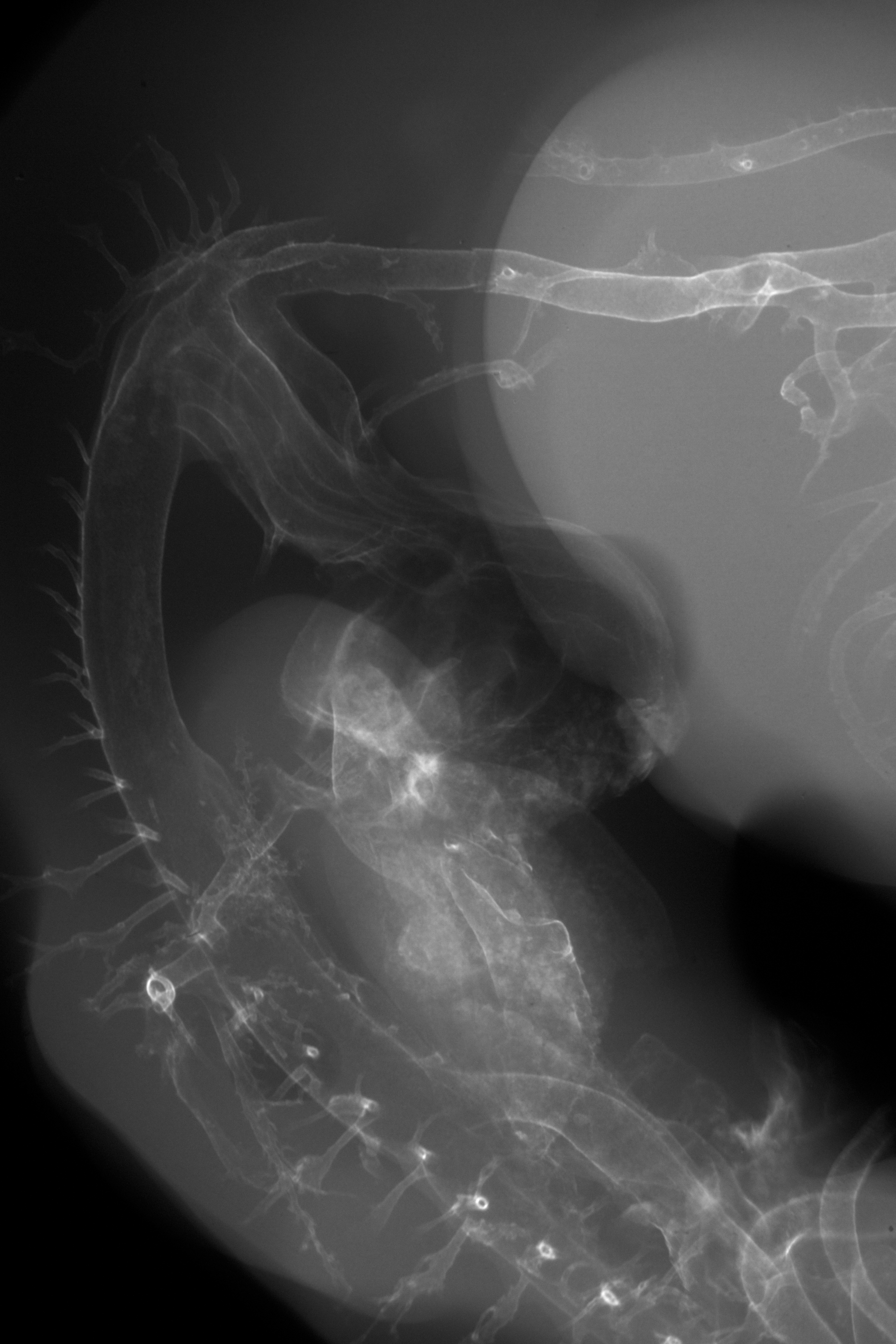 stage 27 chick embryo x-ray
