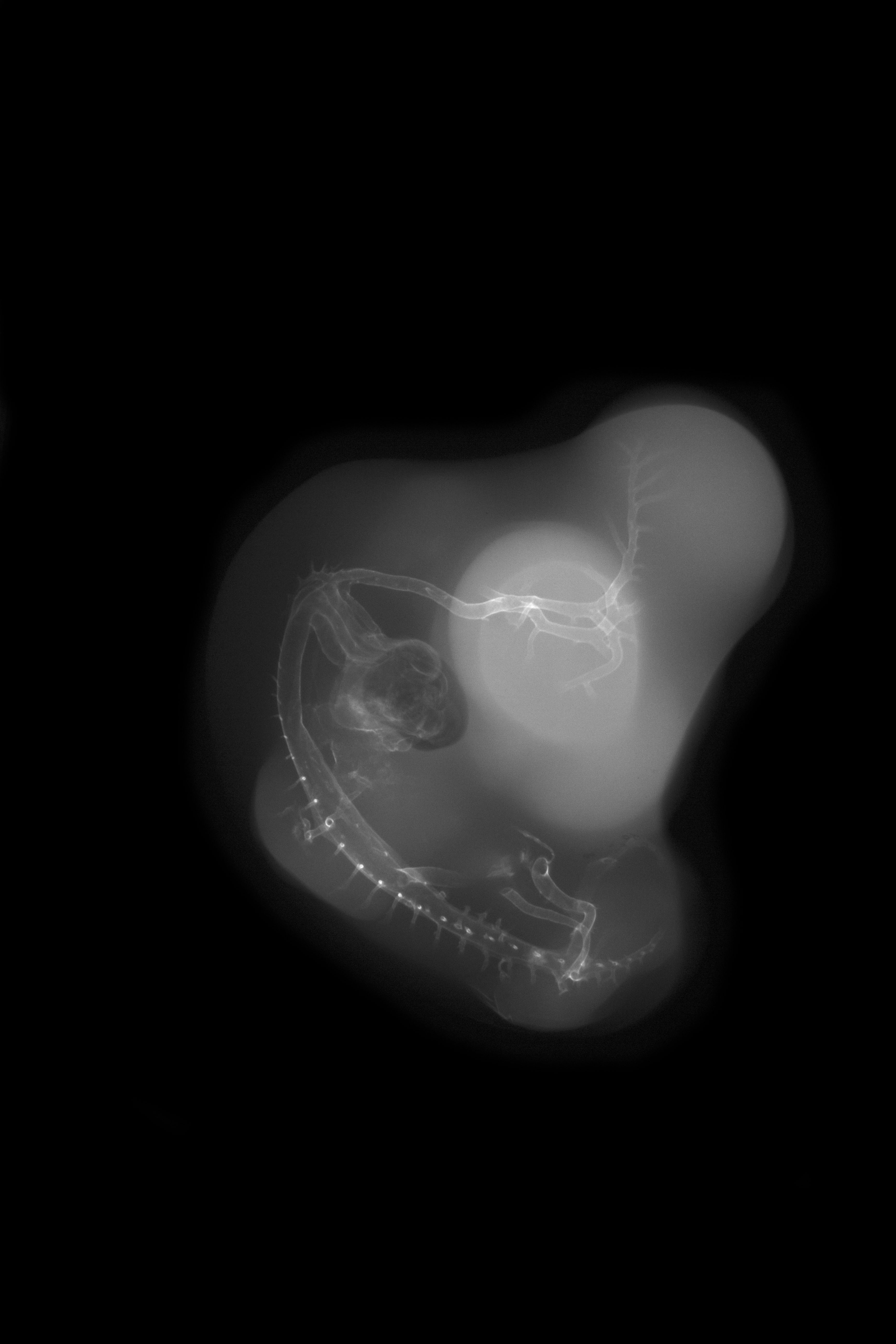 stage 27 chick embryo x-ray