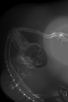 stage 27 chick embryo x-ray