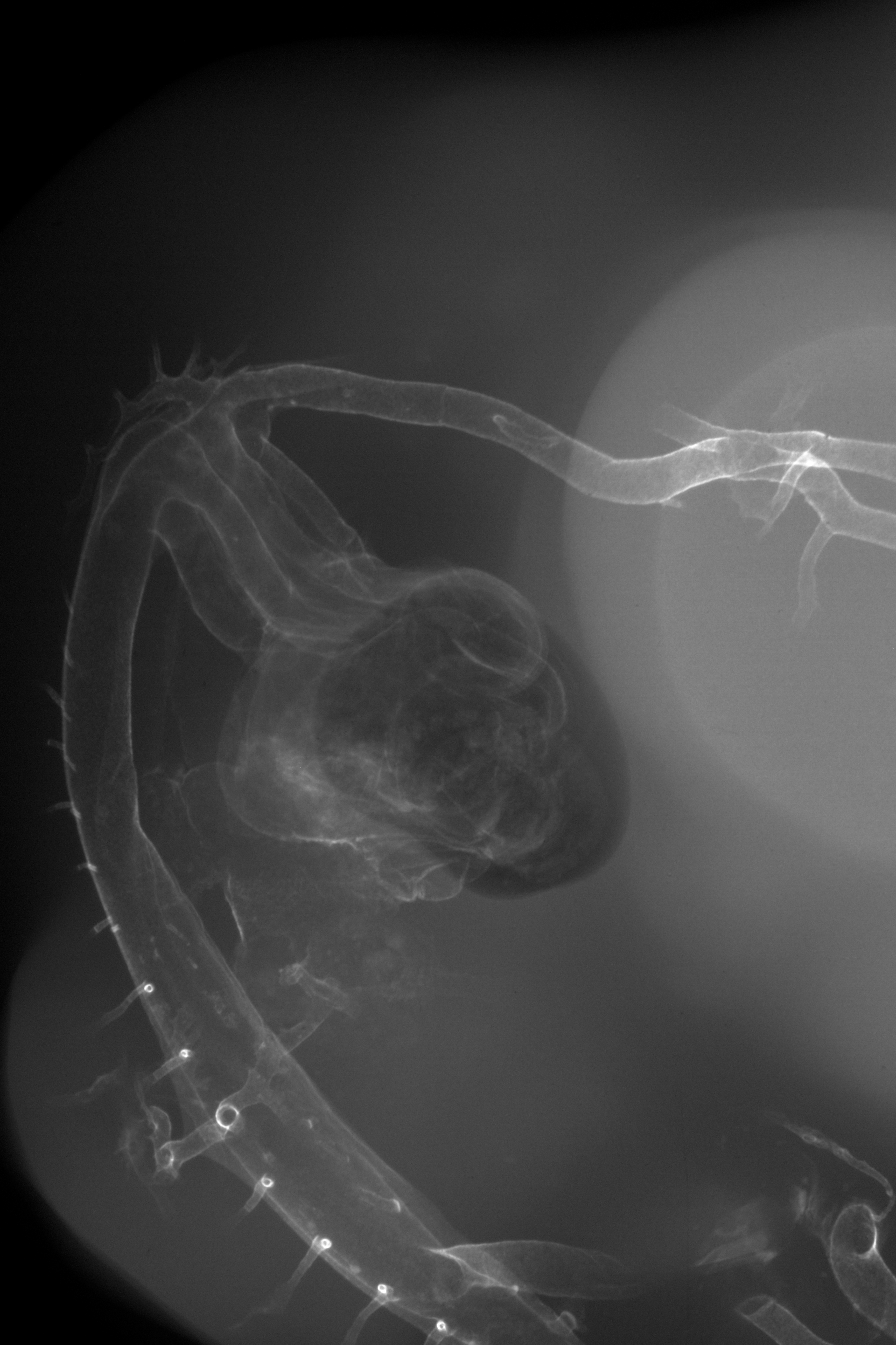 stage 27 chick embryo x-ray