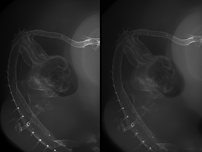 stage 27 chick embryo x-ray