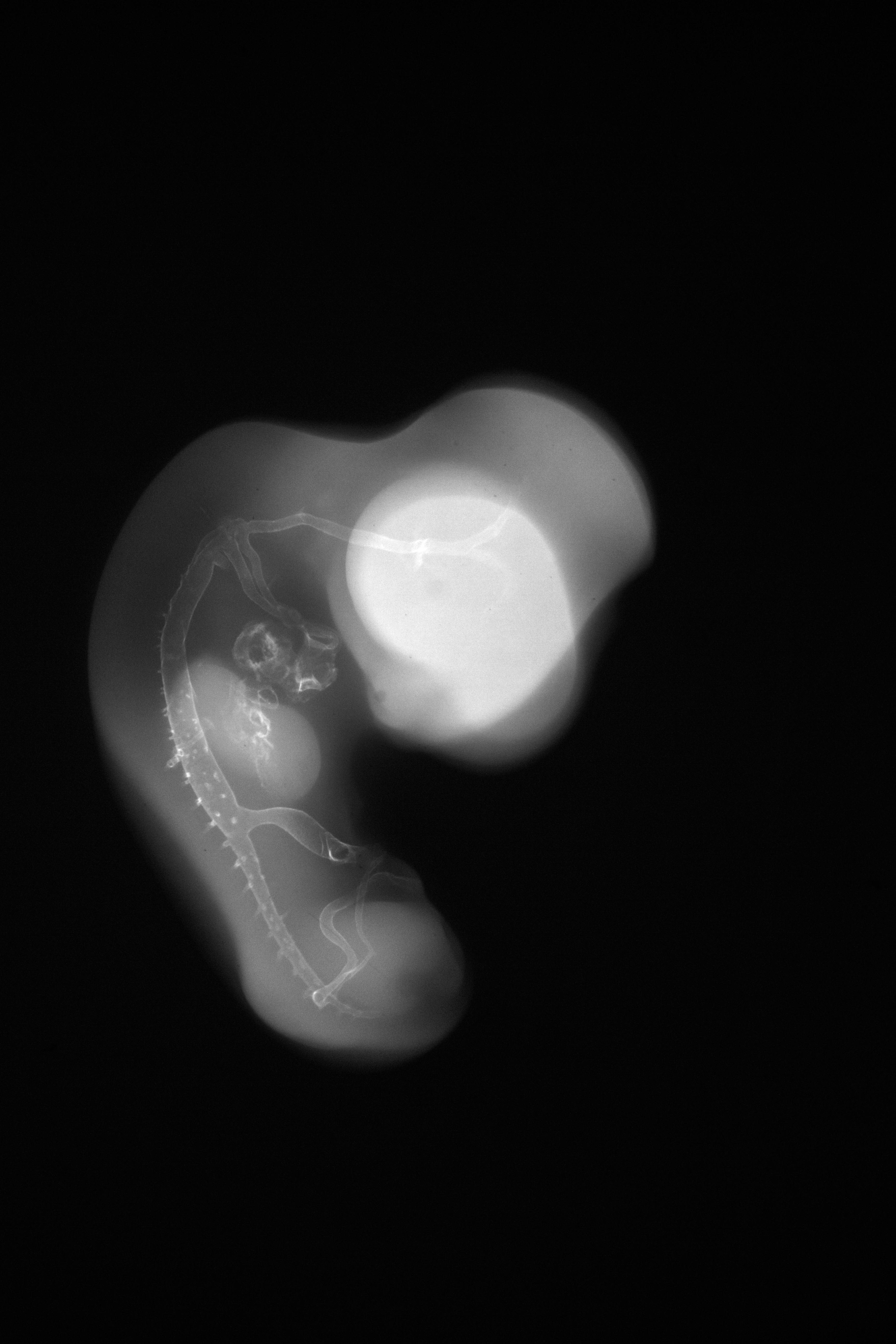 stage 27 chick embryo x-ray