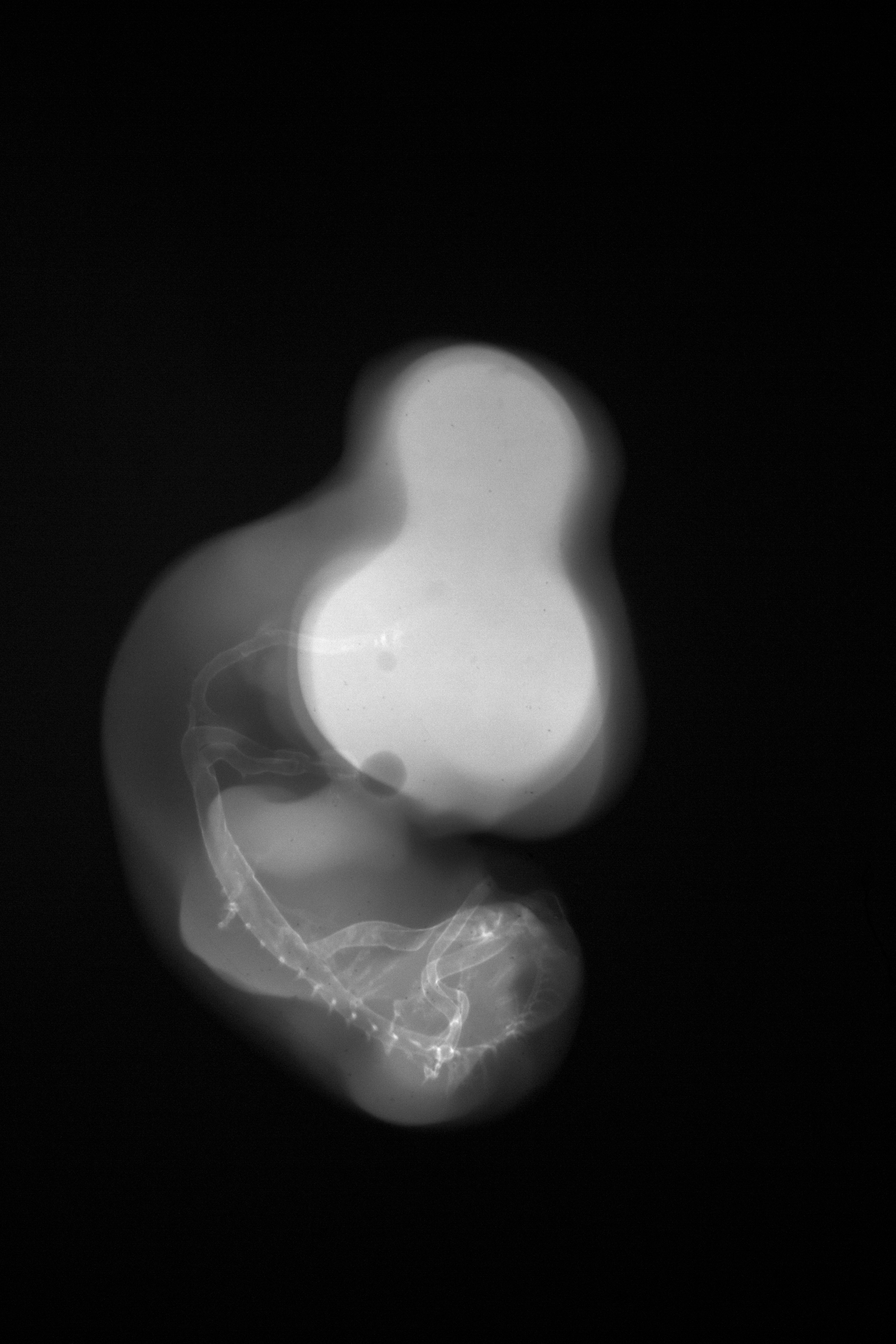 stage 27 chick embryo x-ray