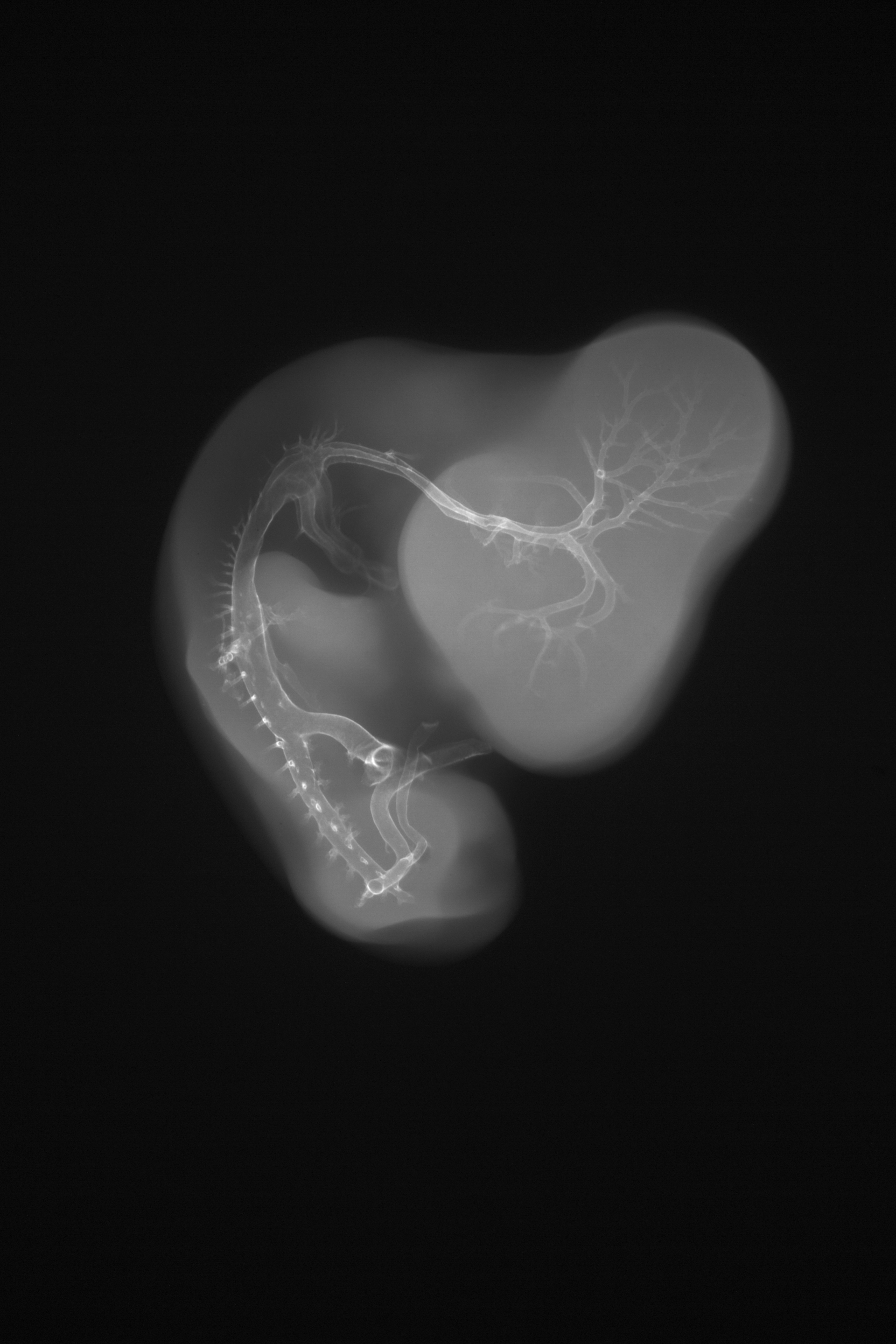 stage 27 chick embryo x-ray