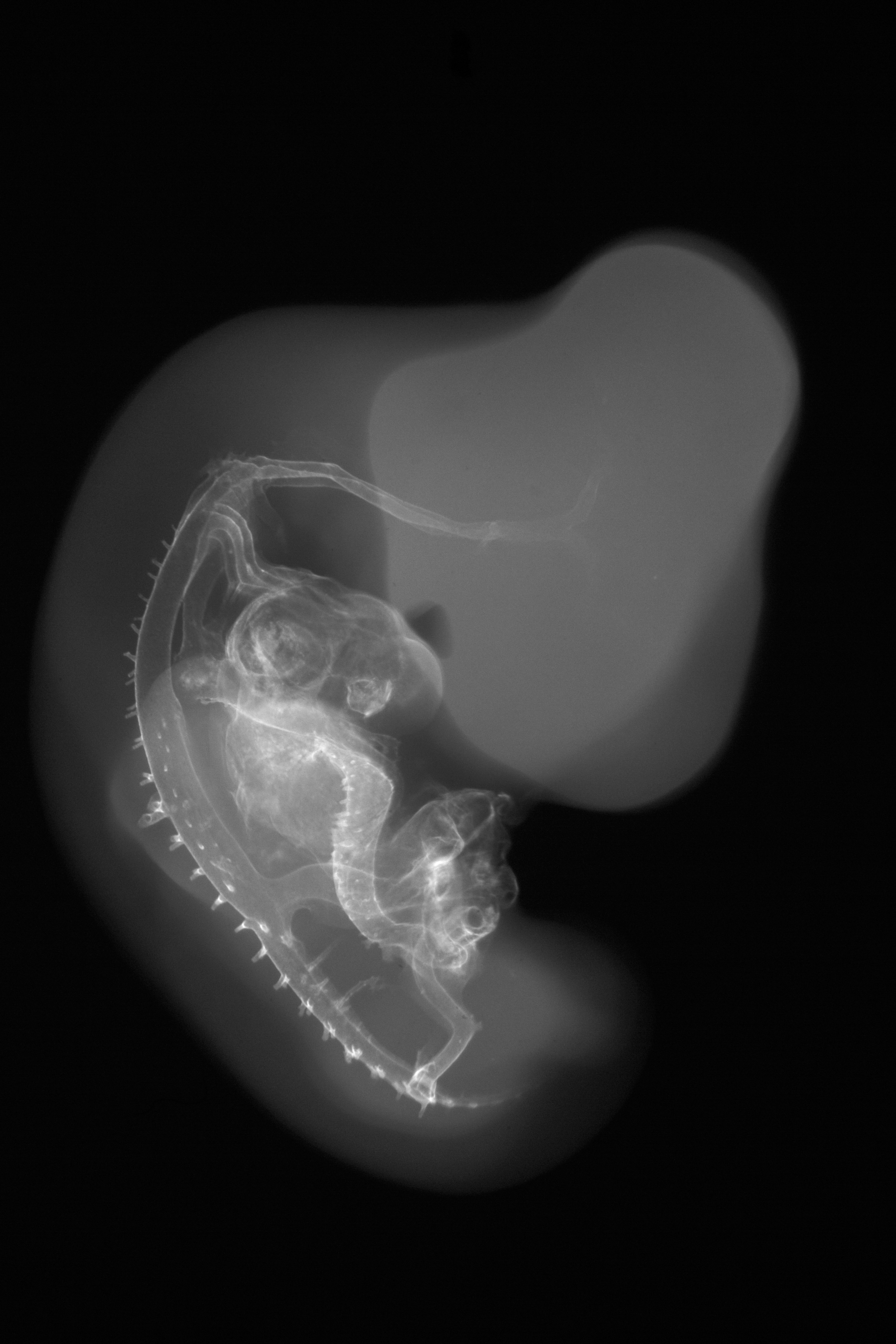 stage 27 chick embryo x-ray