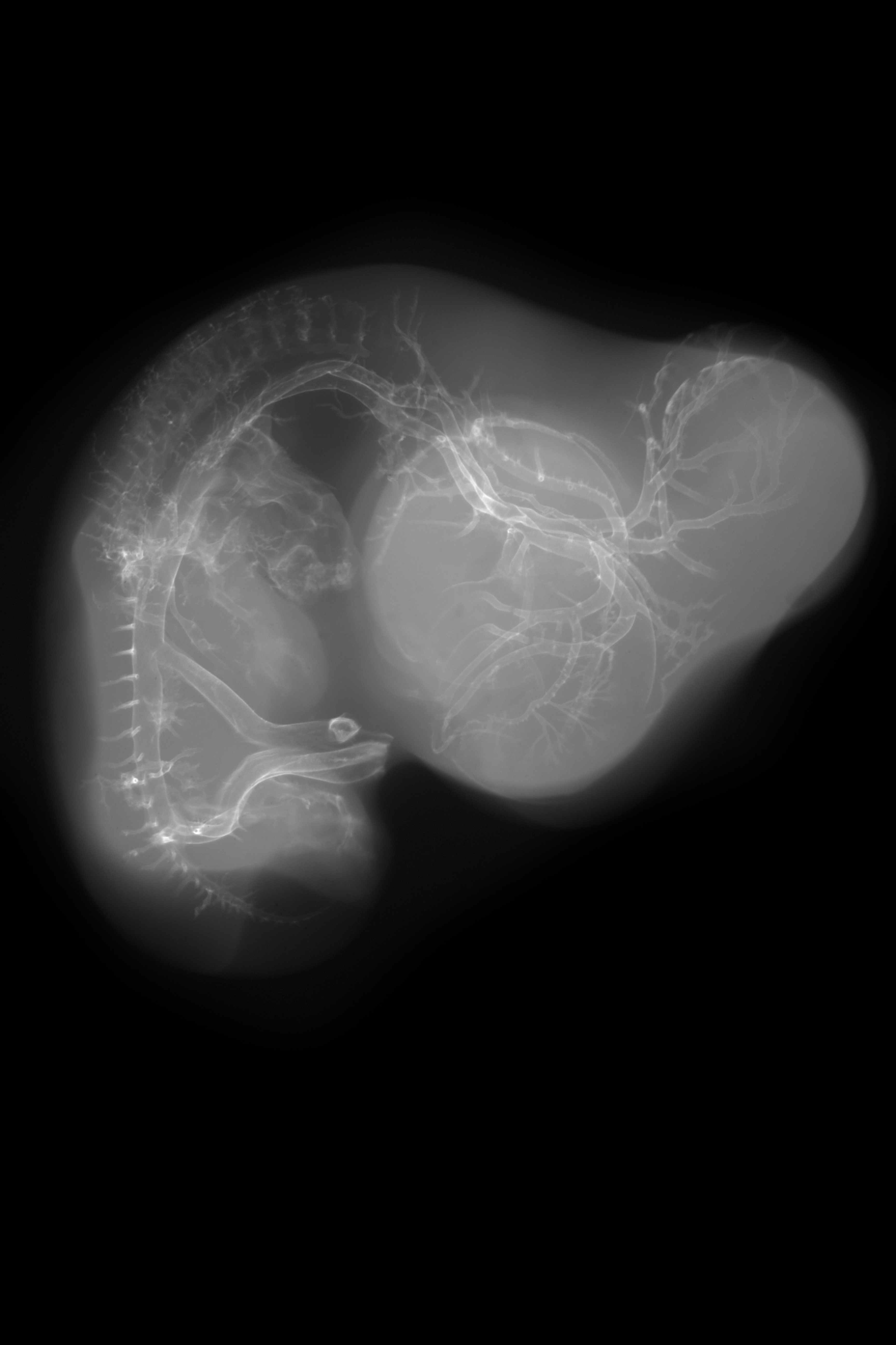 stage 28 chick embryo x-ray