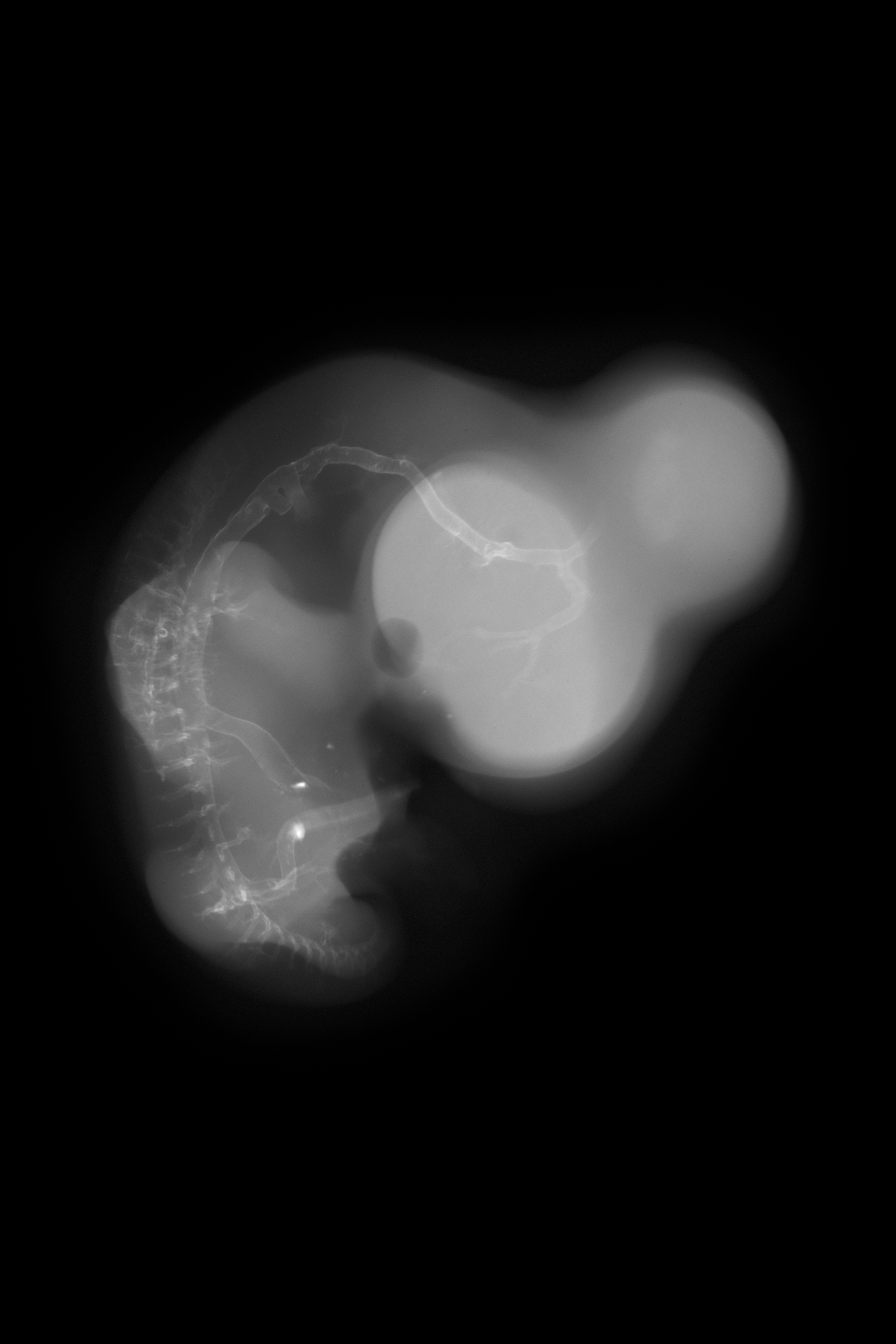 stage 28 chick embryo x-ray
