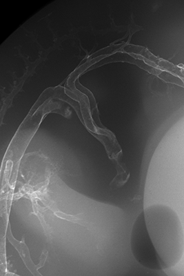 stage 28 chick embryo x-ray