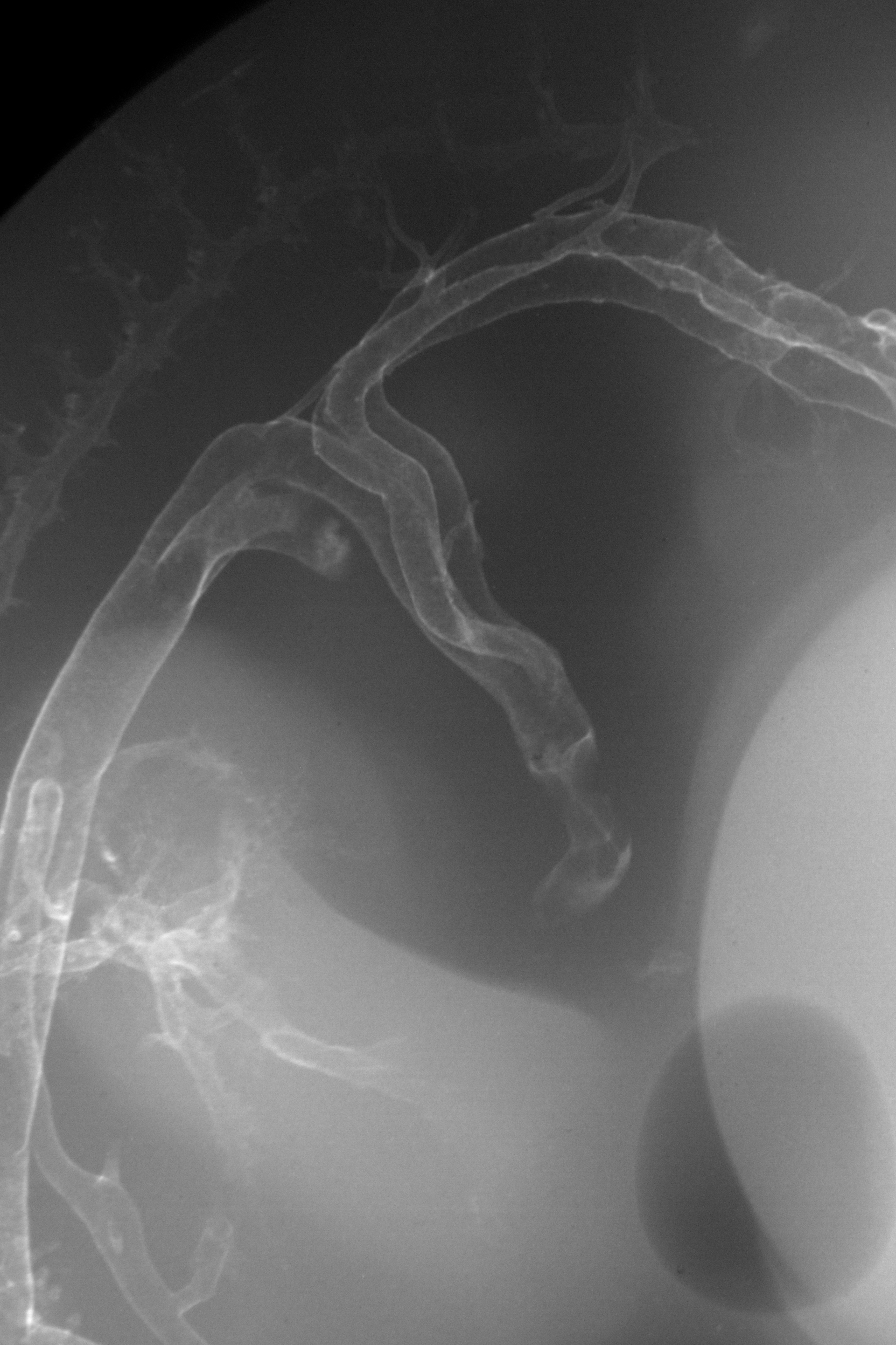 stage 28 chick embryo x-ray